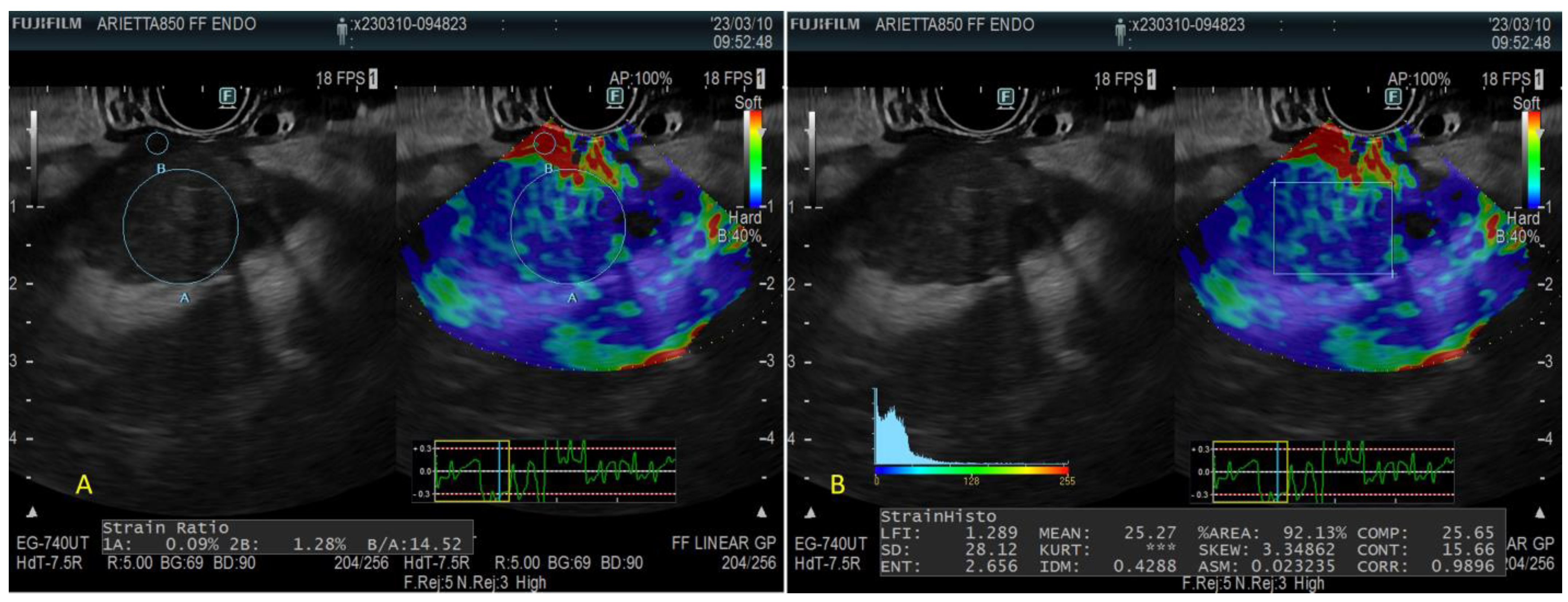 Diagnostics 13 01686 g005 Diagnostics 13 01686 g005