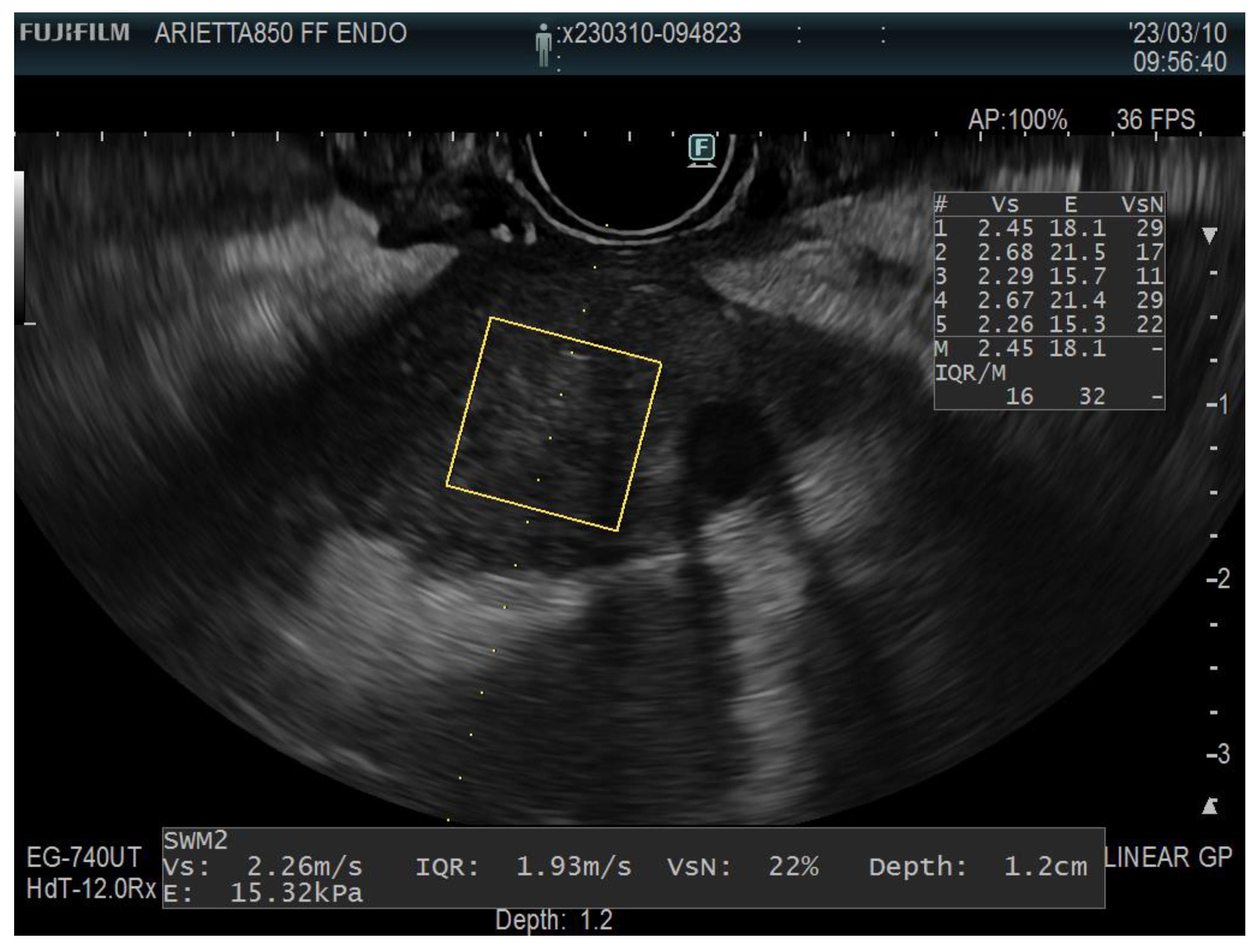 Diagnostics 13 01686 g006 Diagnostics 13 01686 g006