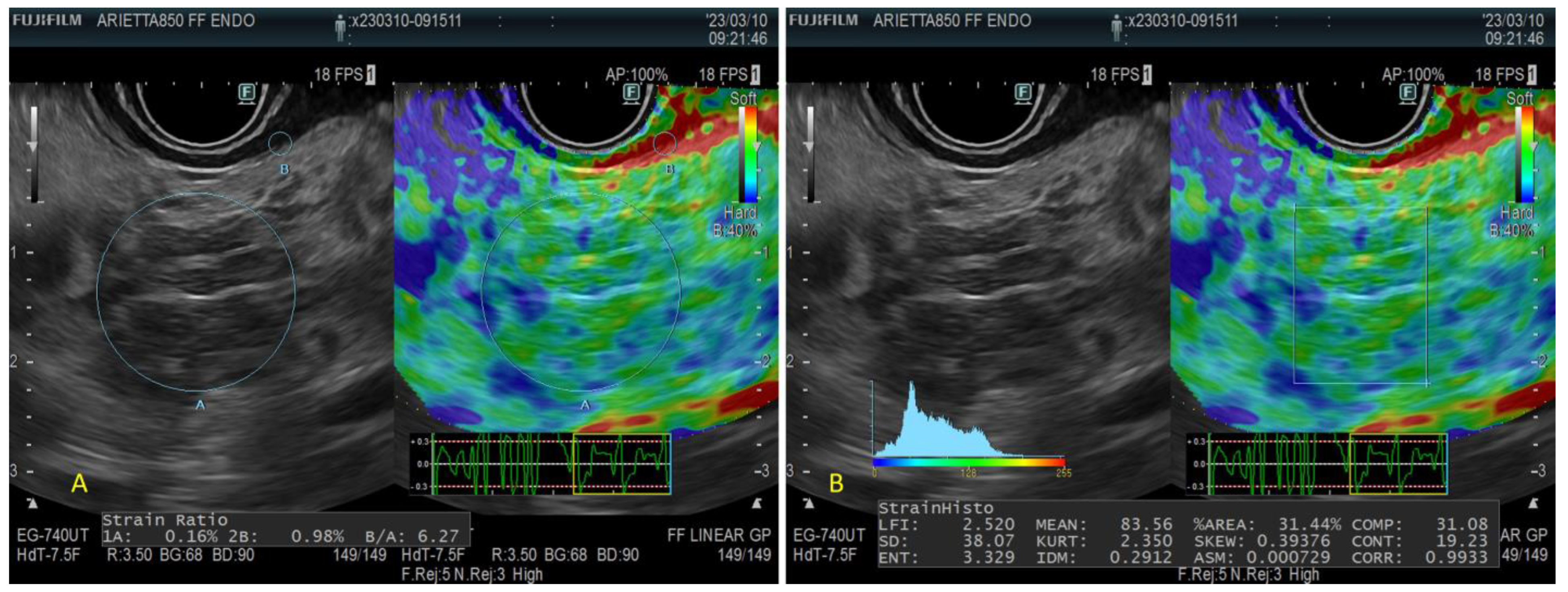 Diagnostics 13 01686 g007 Diagnostics 13 01686 g007