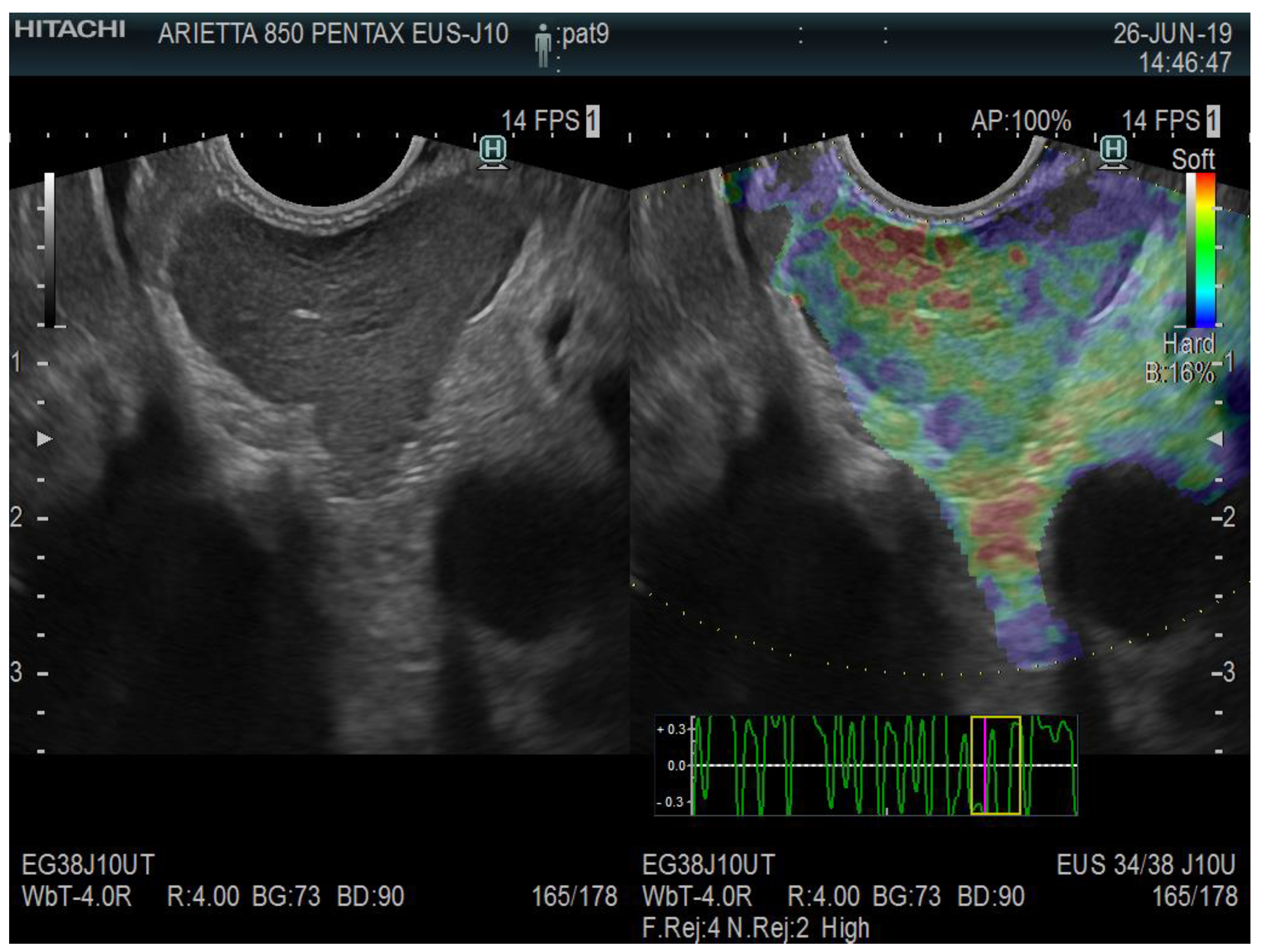 Diagnostics 13 01686 g008 Diagnostics 13 01686 g008