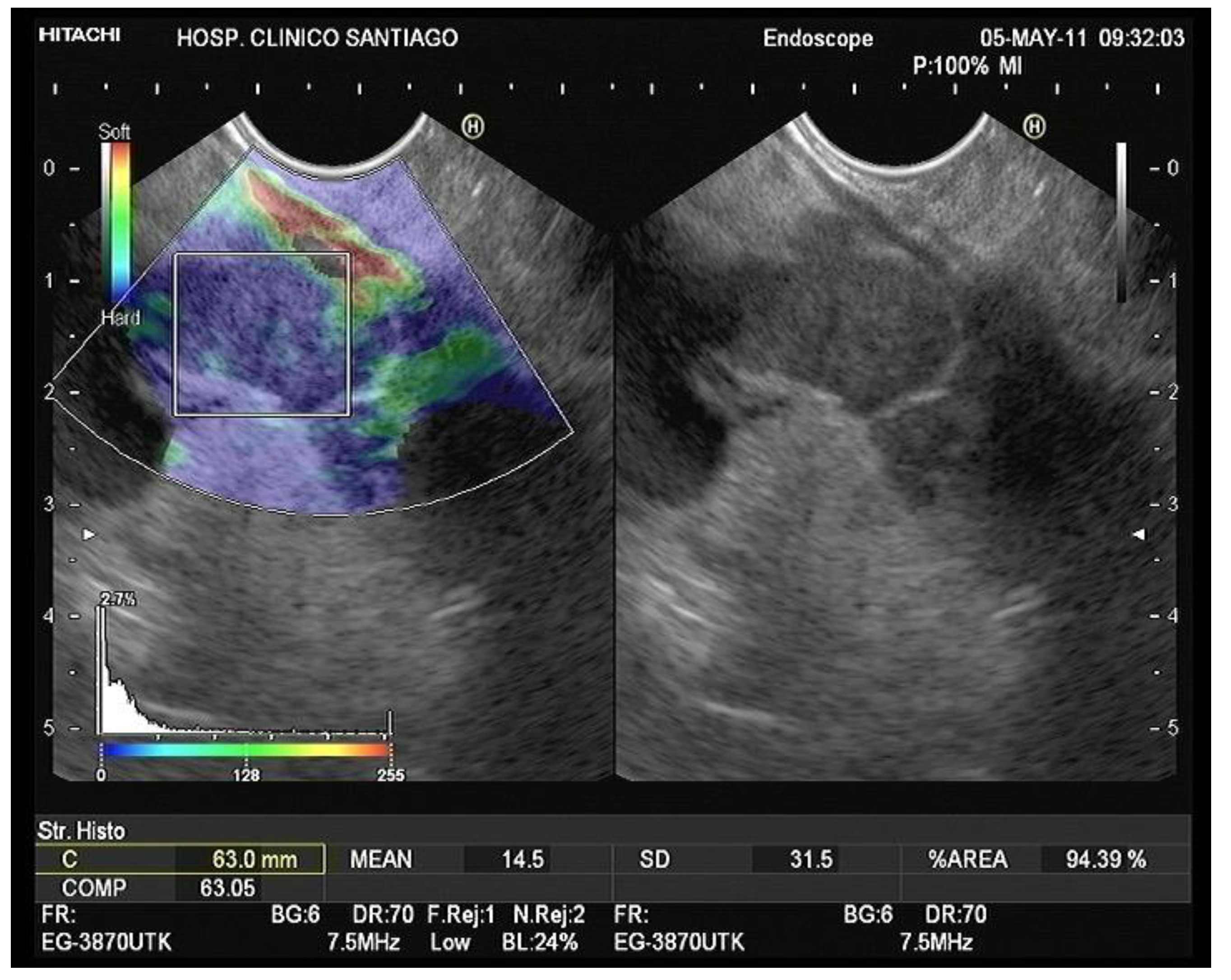 Diagnostics 13 01686 g009 Diagnostics 13 01686 g009