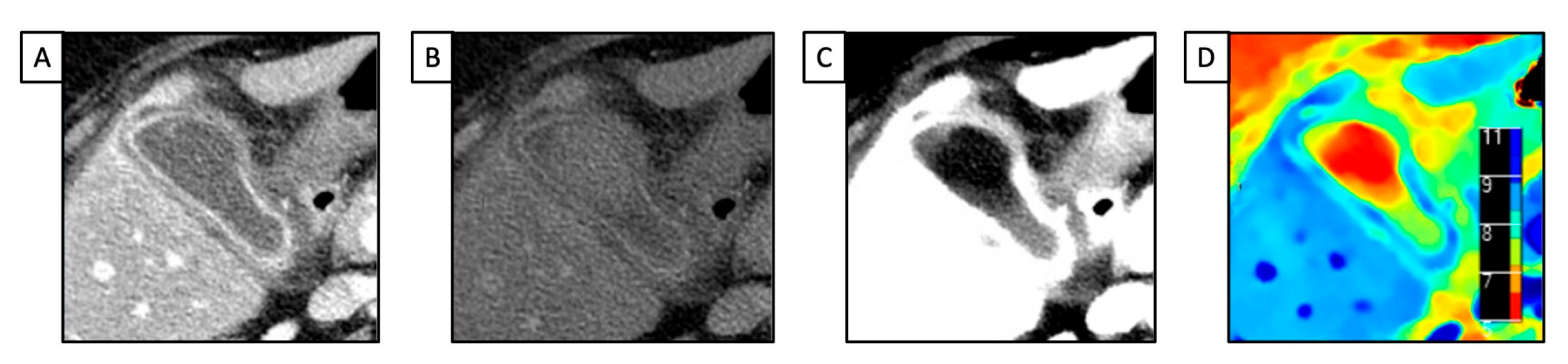 Diagnostics 13 01740 g002 Diagnostics 13 01740 g002