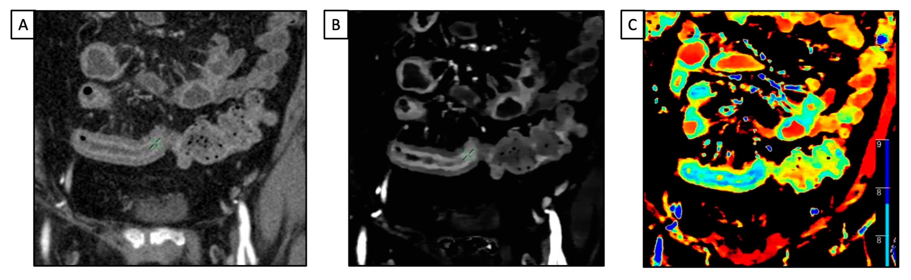 Diagnostics 13 01740 g003 Diagnostics 13 01740 g003