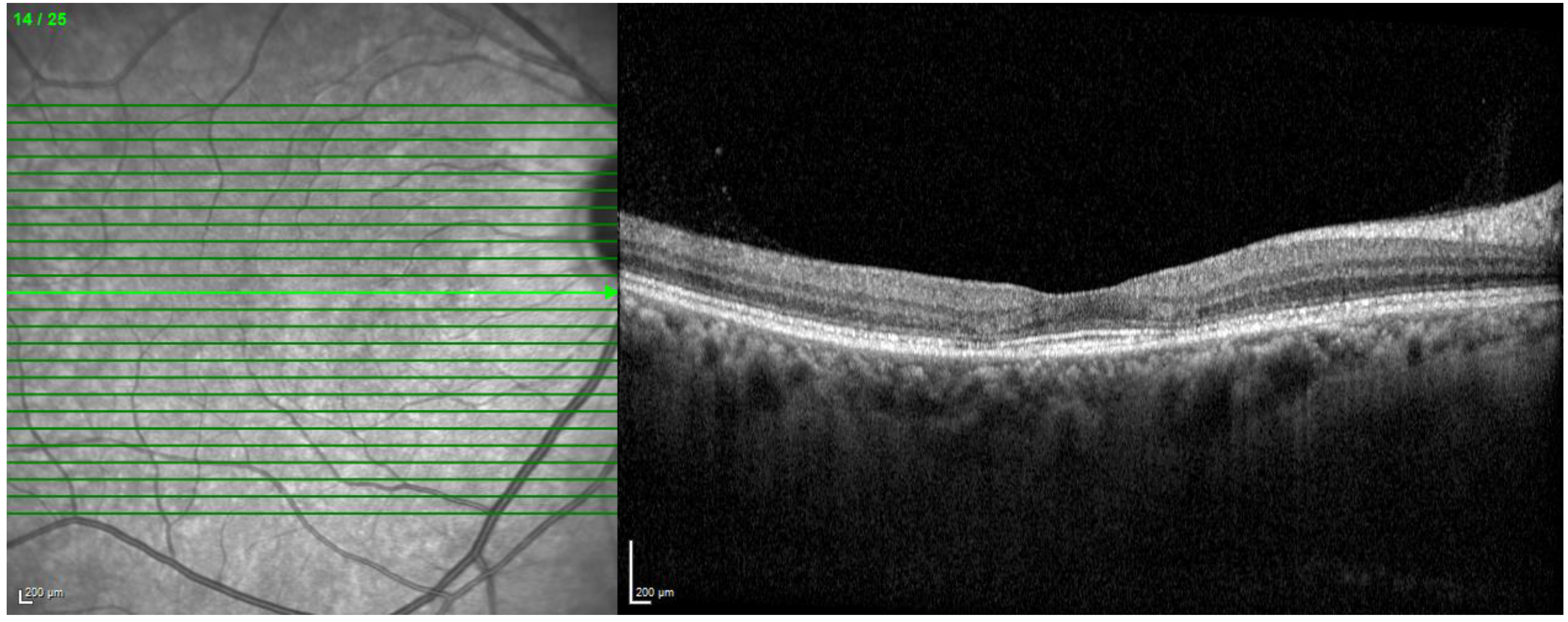 Diagnostics | Free Full-Text | Review of Retinal Imaging