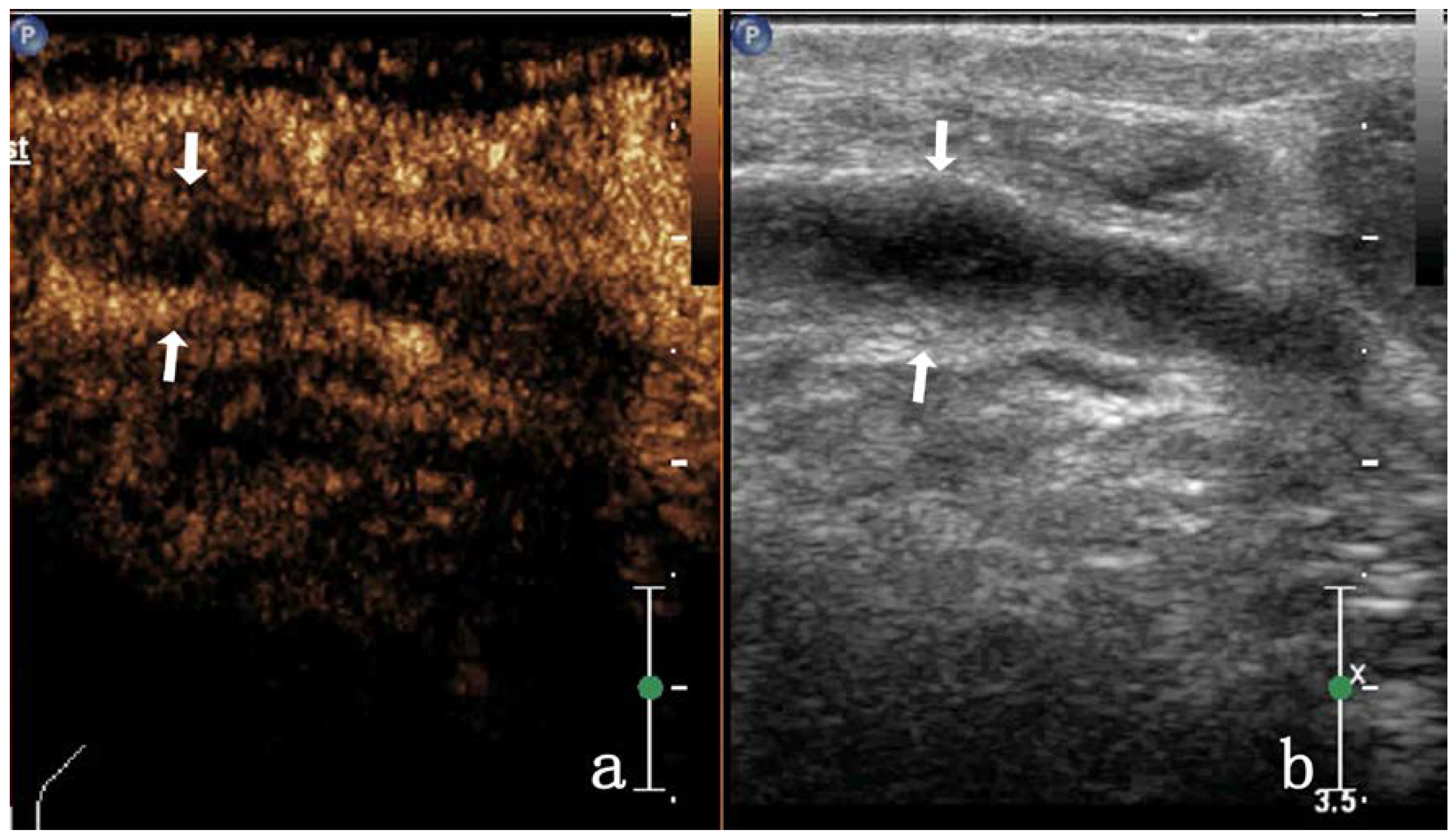 Diagnostics 13 01762 g004 Diagnostics 13 01762 g004