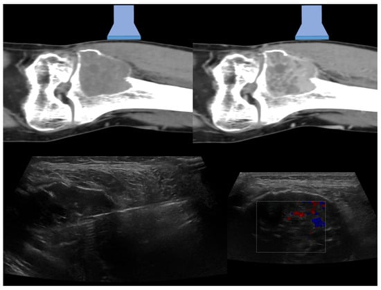 CT & Ultrasound Guided Biopsies