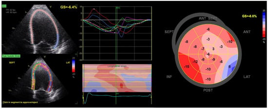 Global longitudinal strain assessment in contrast-enhanced