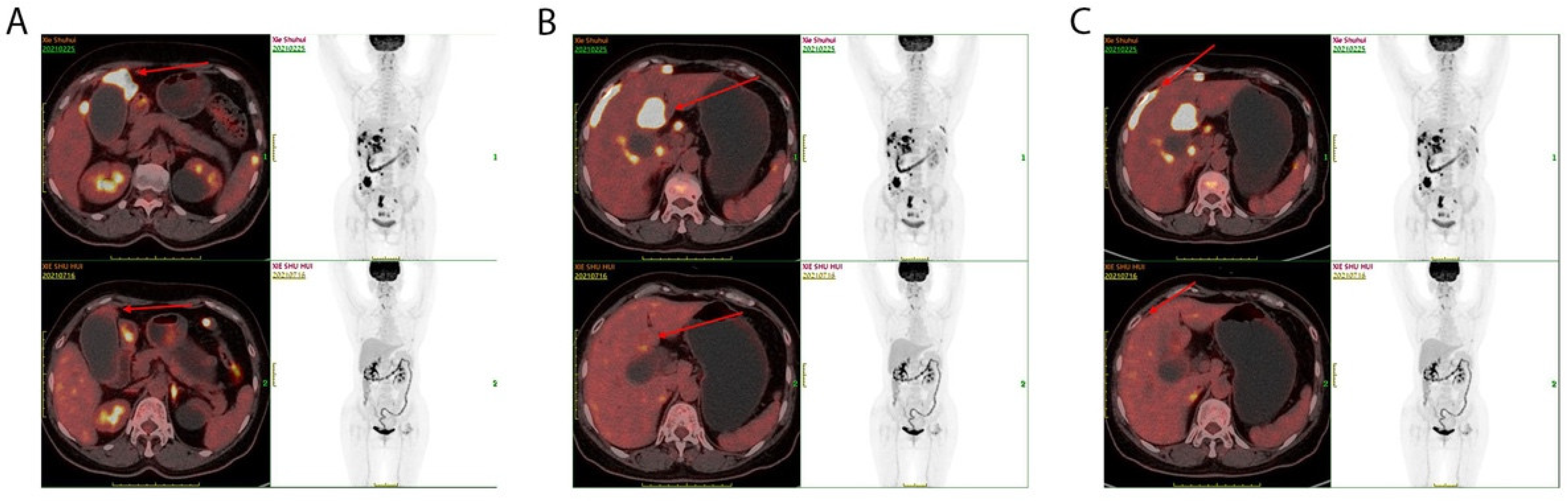 Diagnostics 13 01833 g002 Diagnostics 13 01833 g002