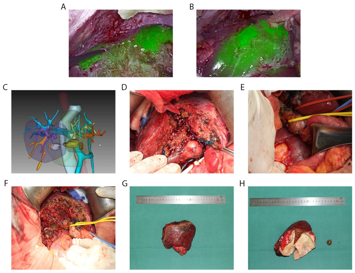 Diagnostics 13 01833 g003 Diagnostics 13 01833 g003