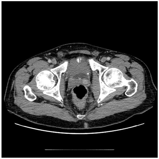 Black Cat Scans Bc Series Nude - Diagnostics | Free Full-Text | Contemporary Review of Multimodality Imaging  of the Prostate Gland