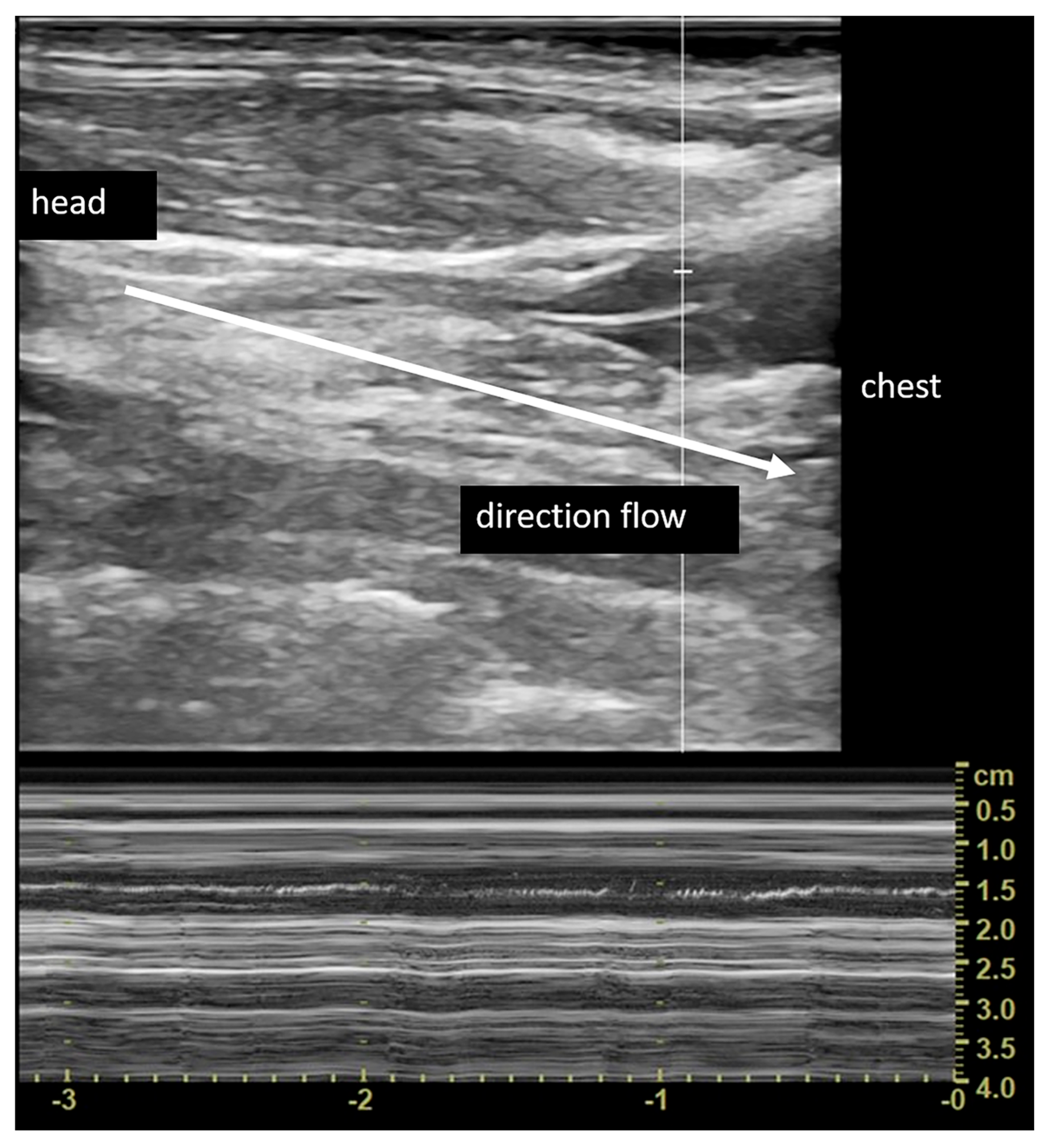 Diagnostics, Free Full-Text