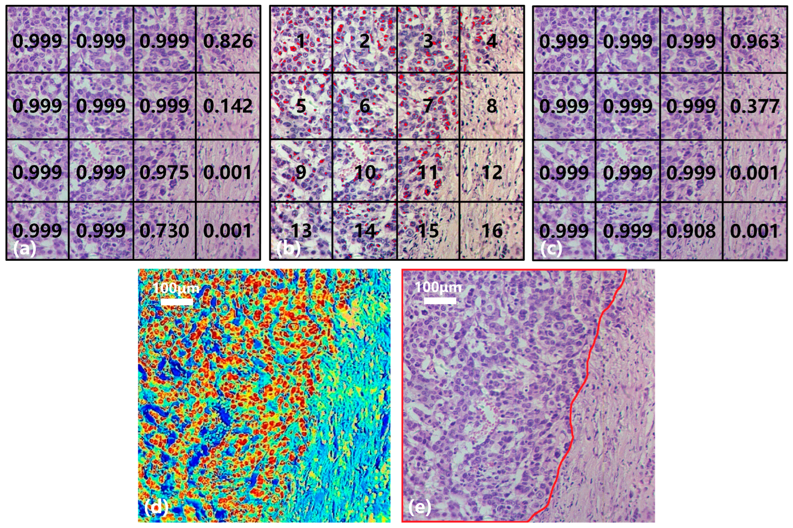Diagnostics 13 02002 g011 Diagnostics 13 02002 g011