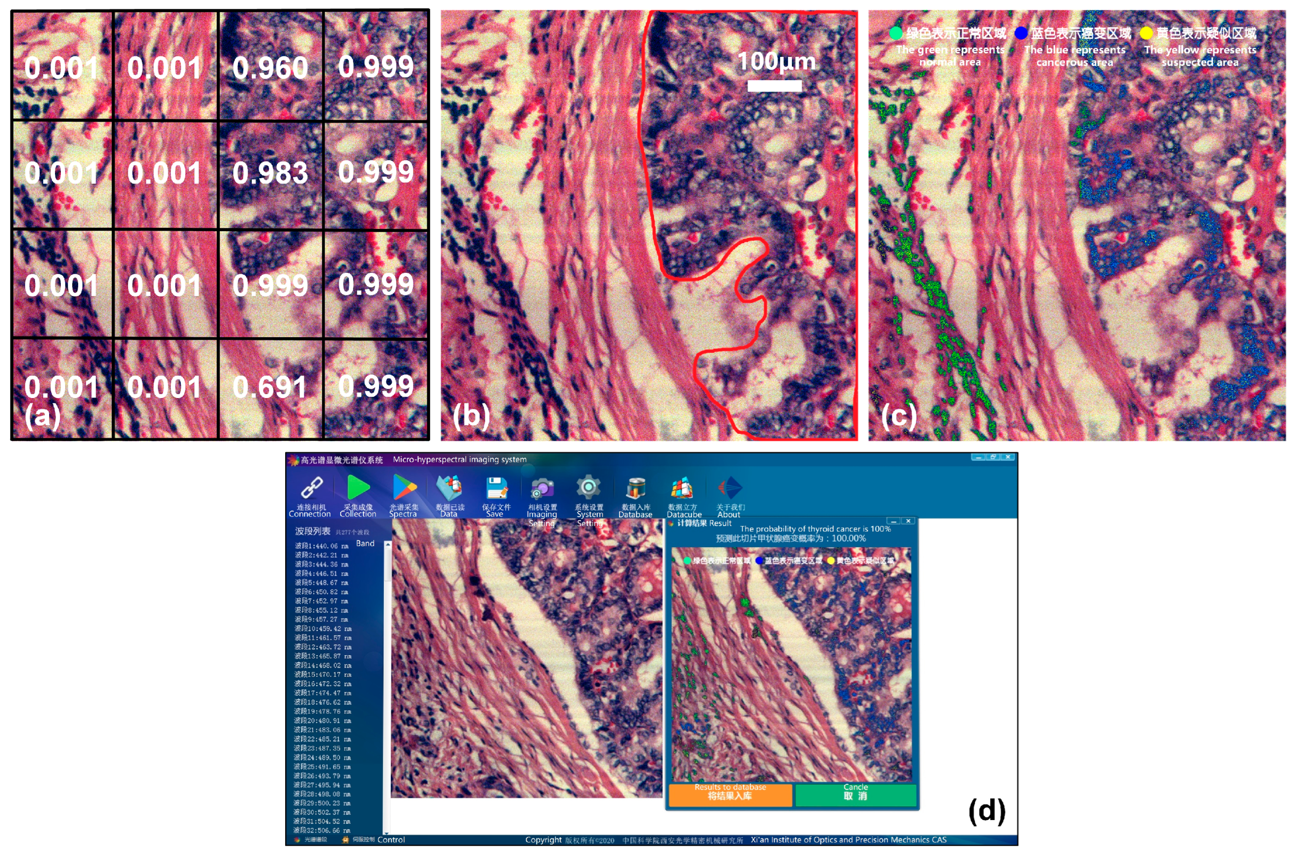 Diagnostics 13 02002 g013 Diagnostics 13 02002 g013