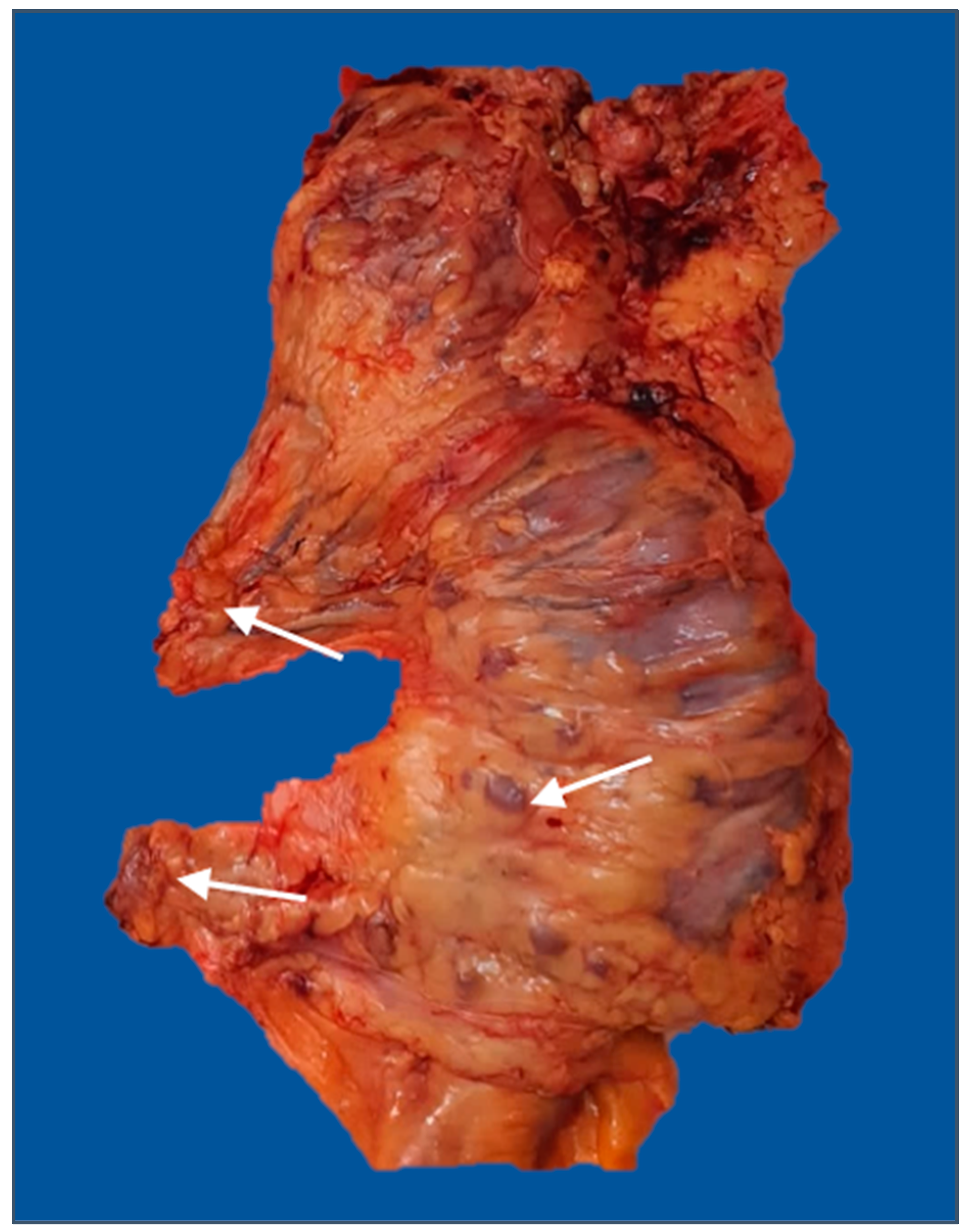 Diagnostics 13 02016 g004 Diagnostics 13 02016 g004