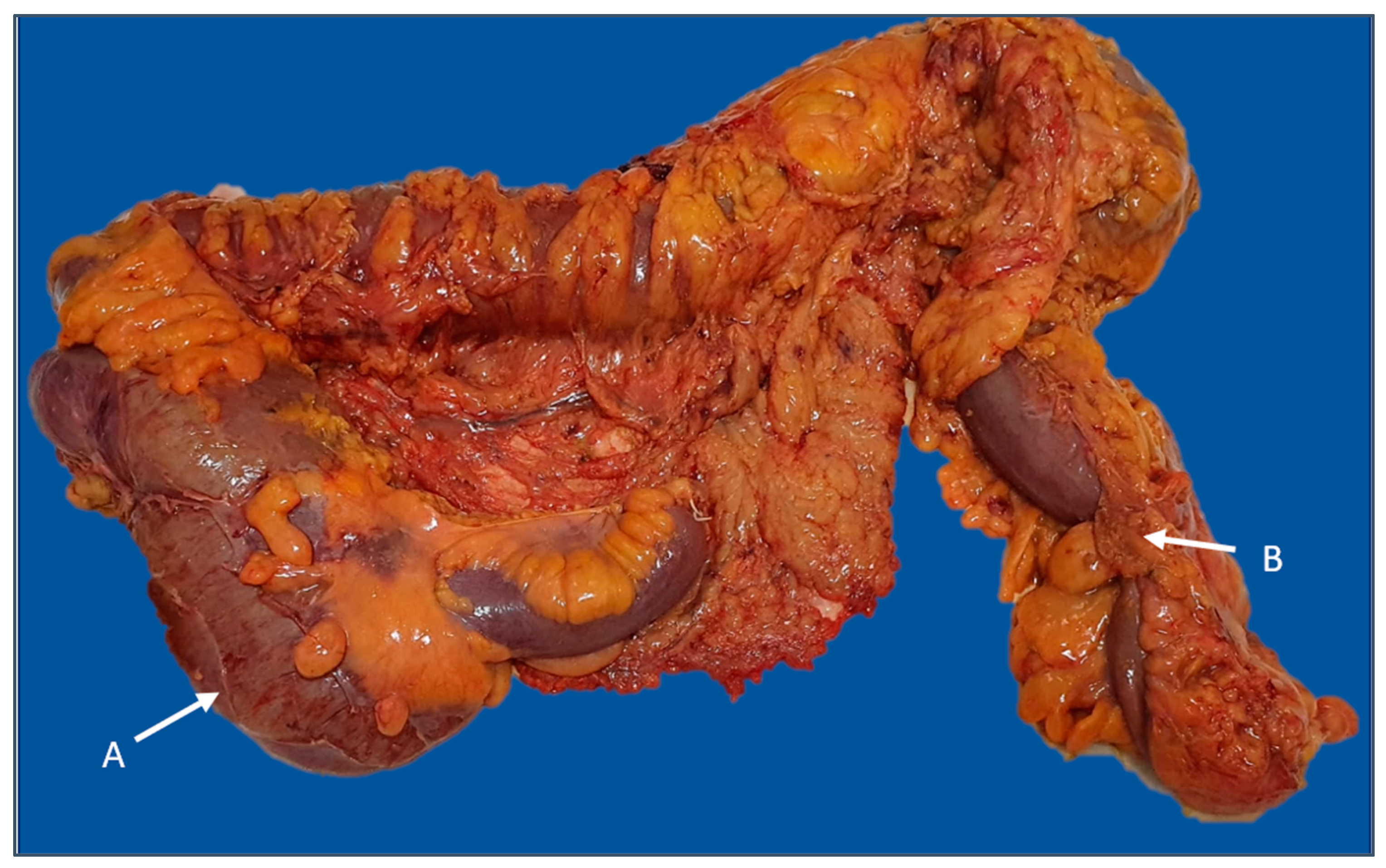 Diagnostics 13 02016 g005 Diagnostics 13 02016 g005