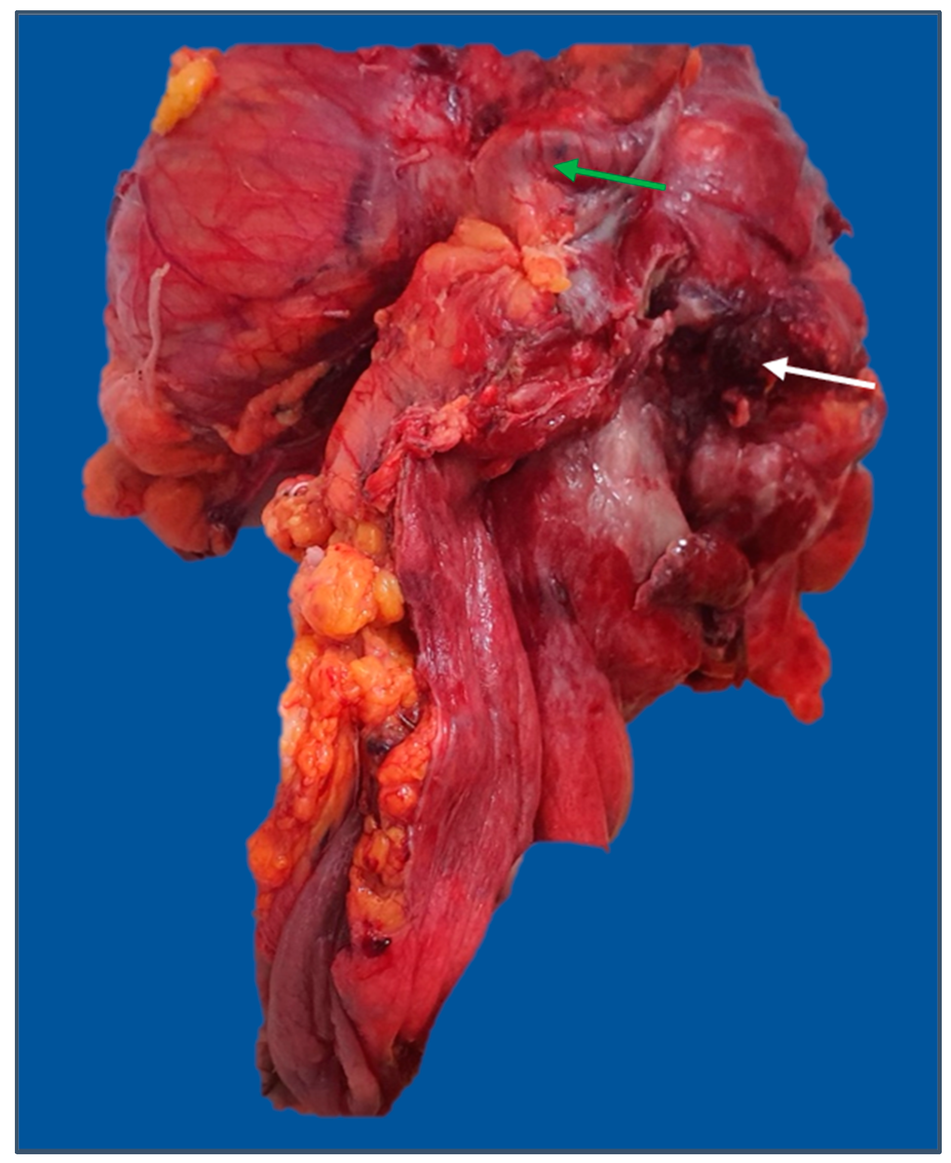 Diagnostics 13 02016 g006 Diagnostics 13 02016 g006