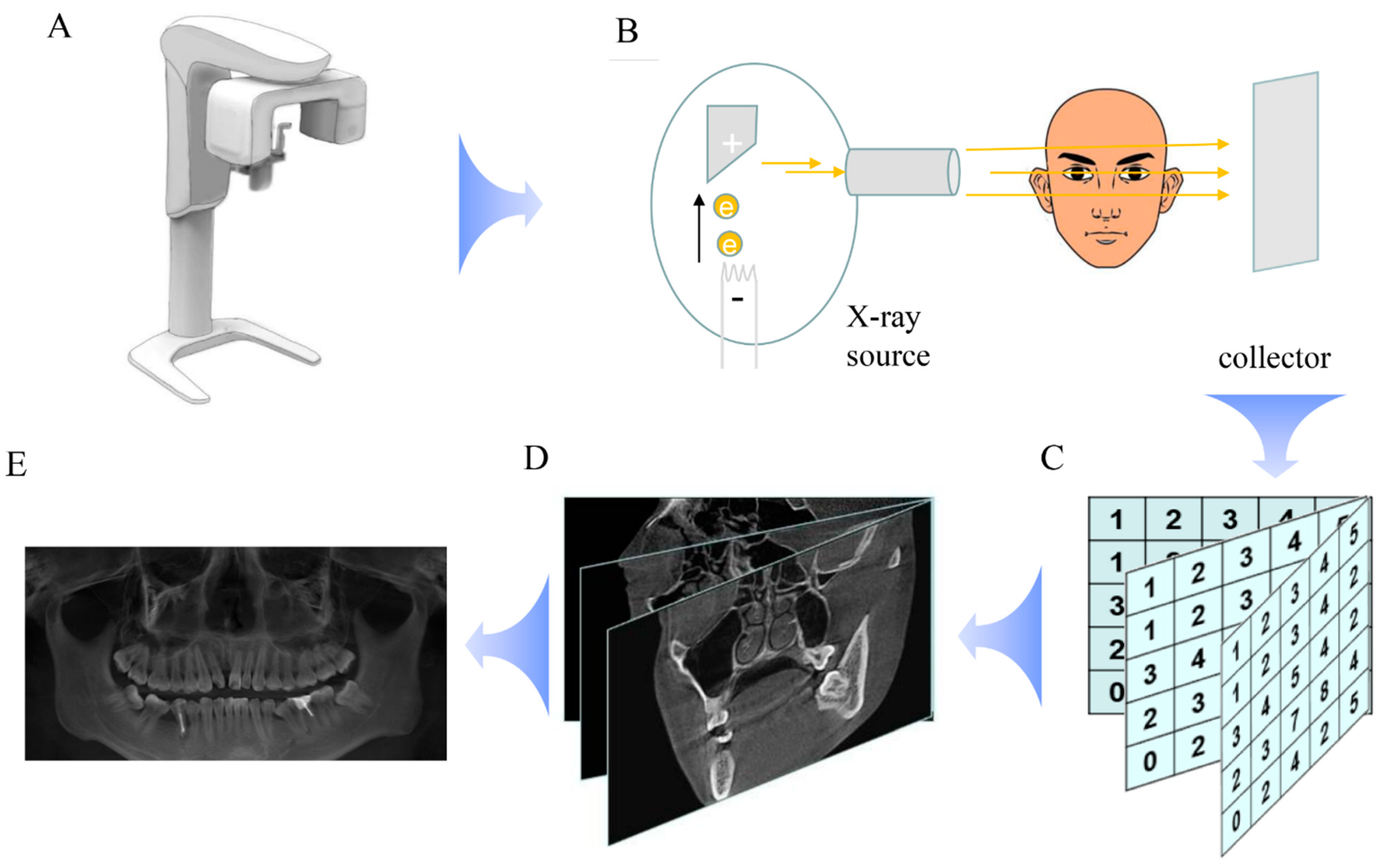Canal-Net for automatic and robust 3D segmentation of mandibular canals in  CBCT images using a continuity-aware contextual network