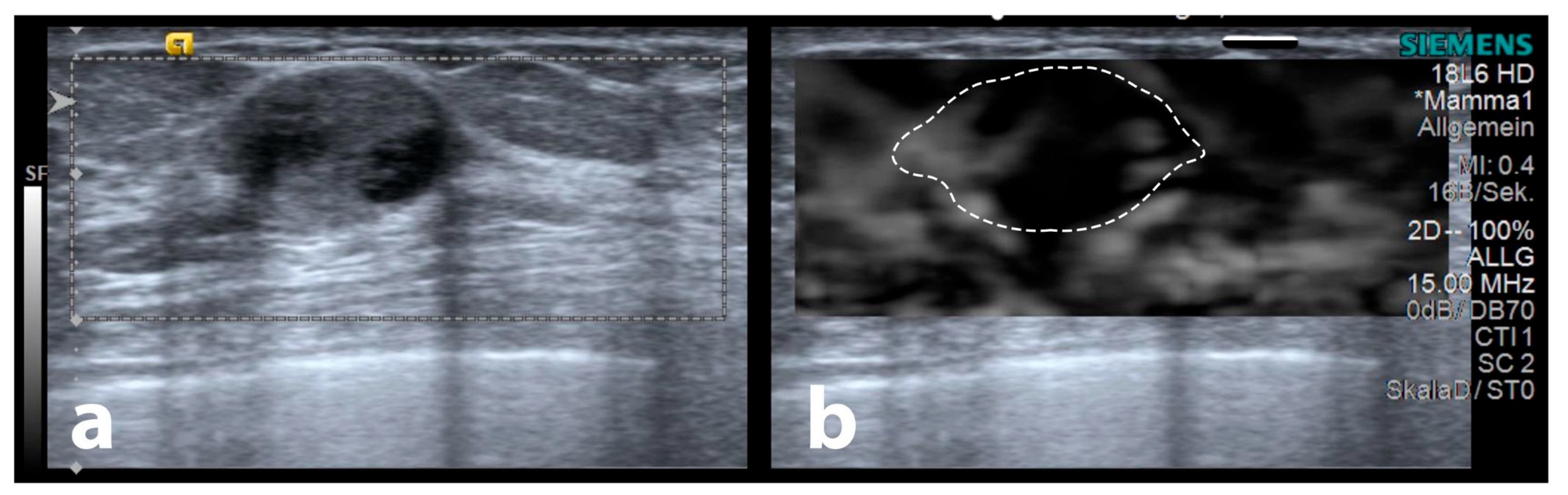 Diagnostics 13 02064 g008