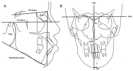 Schema of jaw and neck muscle coordination while chewing gum on the