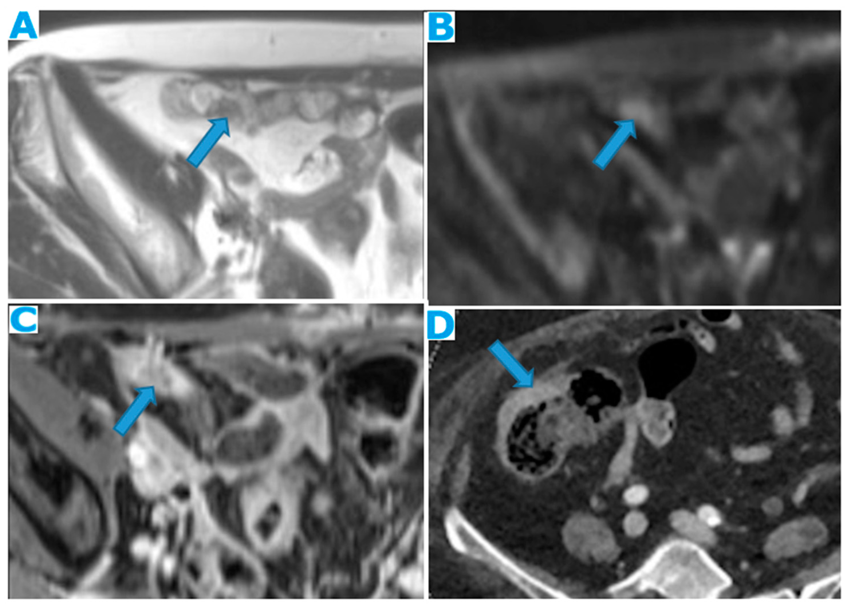 Diagnostics 13 02253 g022 Diagnostics 13 02253 g022
