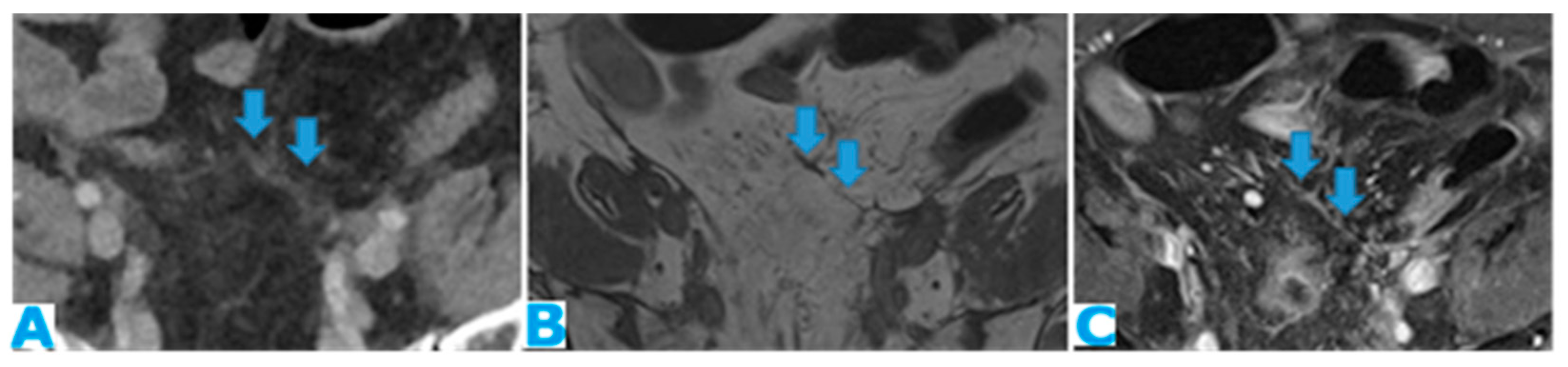 Diagnostics 13 02253 g024 Diagnostics 13 02253 g024