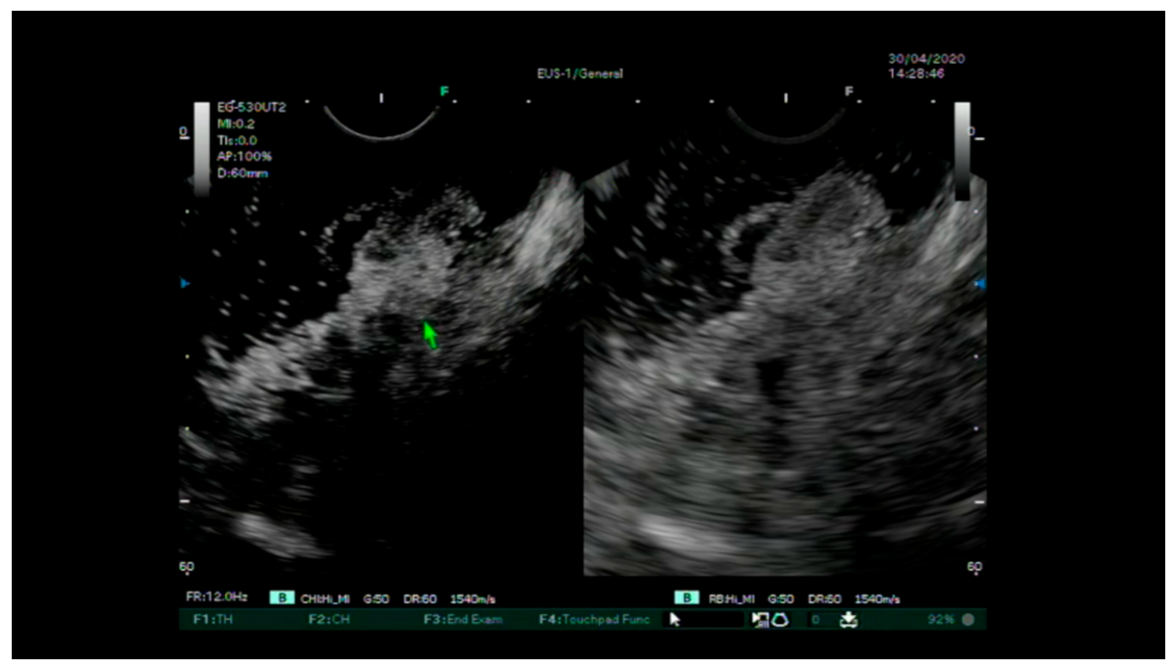 Diagnostics 13 02267 g002 Diagnostics 13 02267 g002