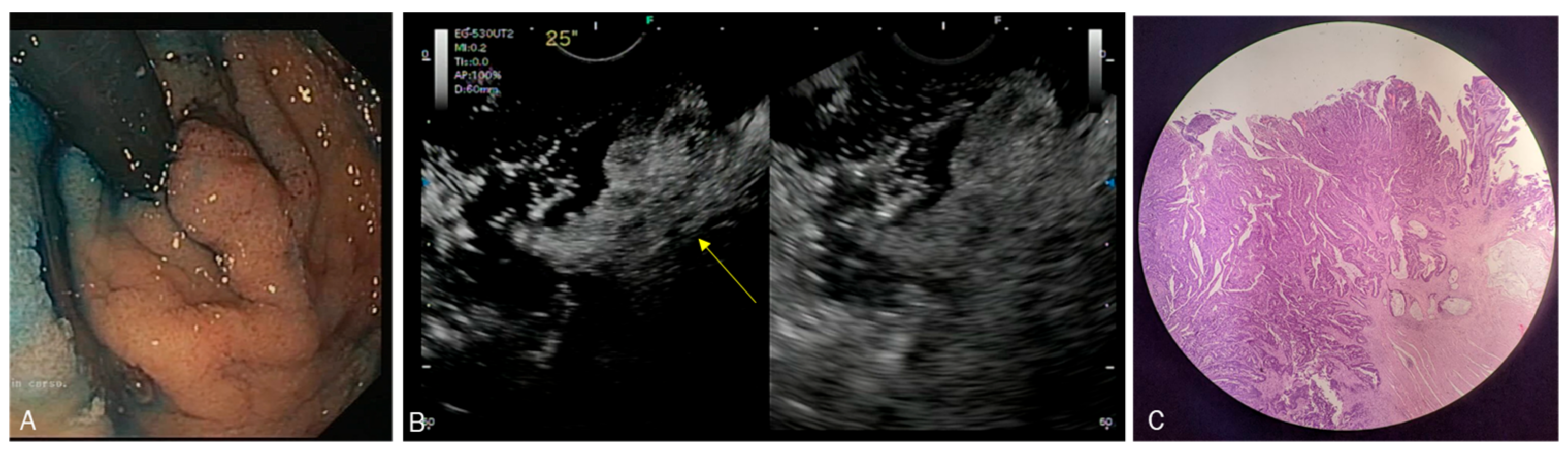 Diagnostics 13 02267 g004 Diagnostics 13 02267 g004