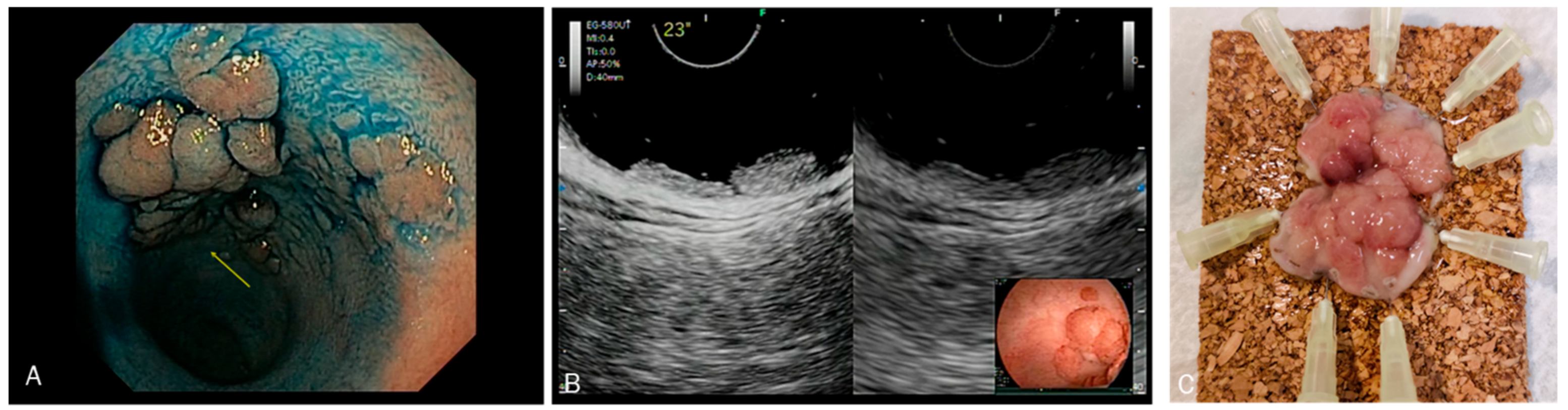 Diagnostics 13 02267 g005 Diagnostics 13 02267 g005