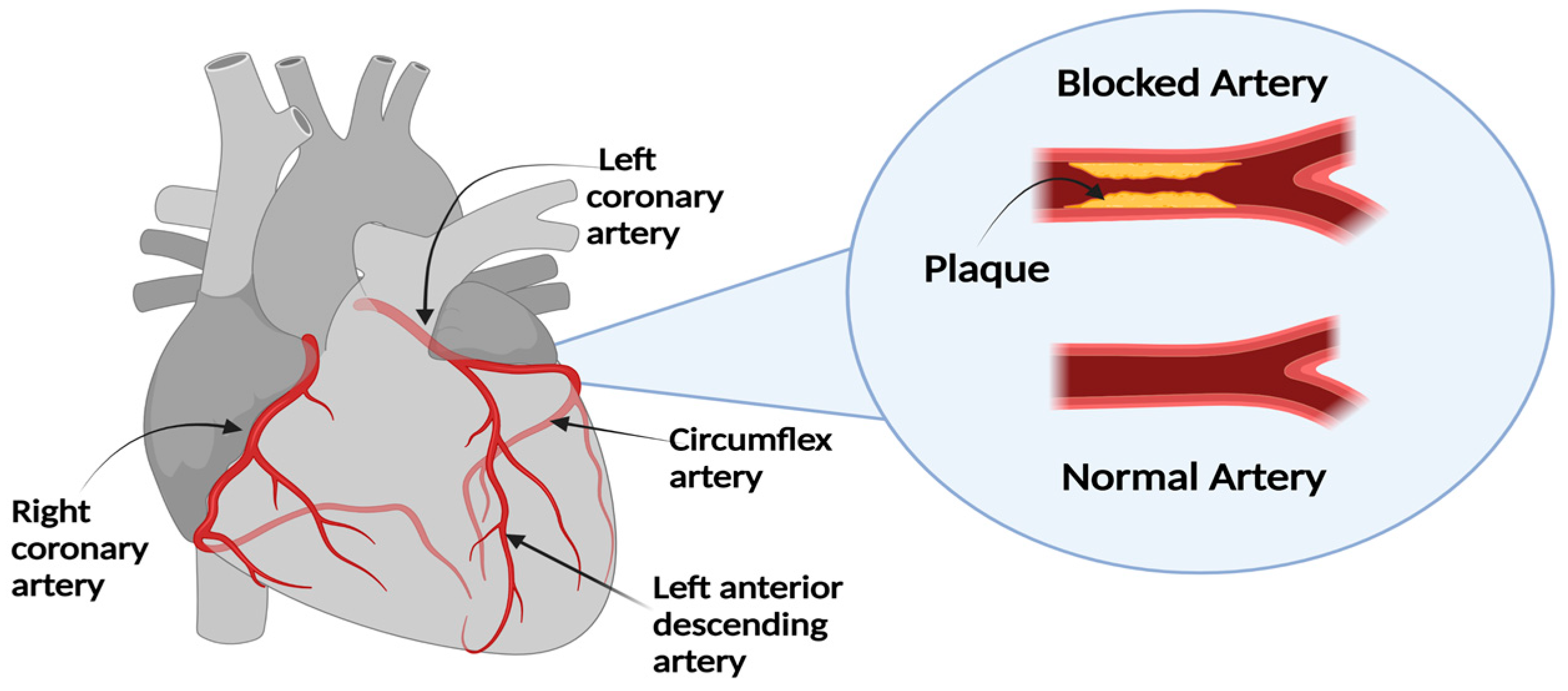 coronary arteries diagram