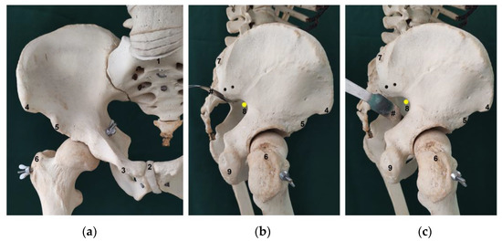 The Sciatic Nerve exits the Greater Sciatic Notch (green circle)