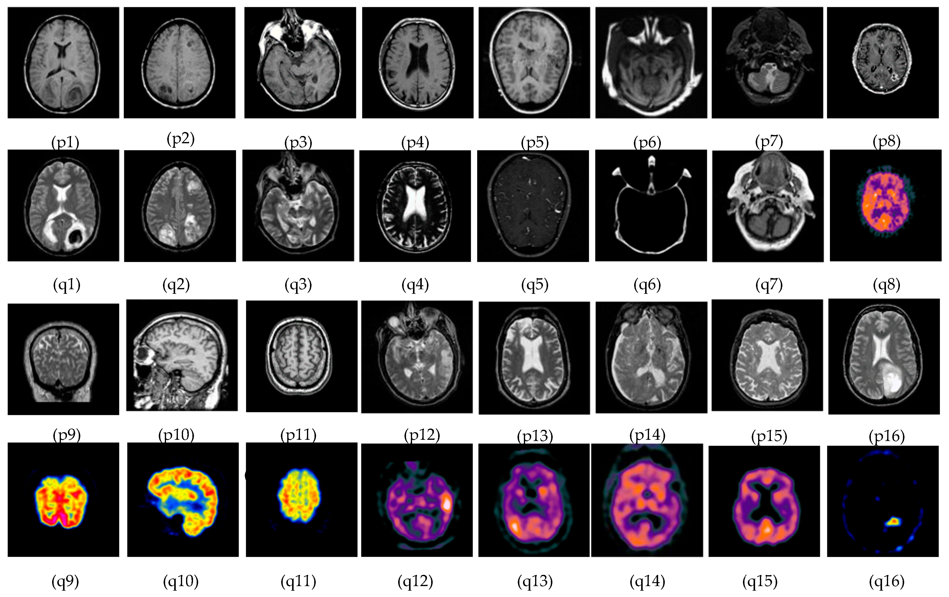 Diagnostics 13 02330 g003 Diagnostics 13 02330 g003
