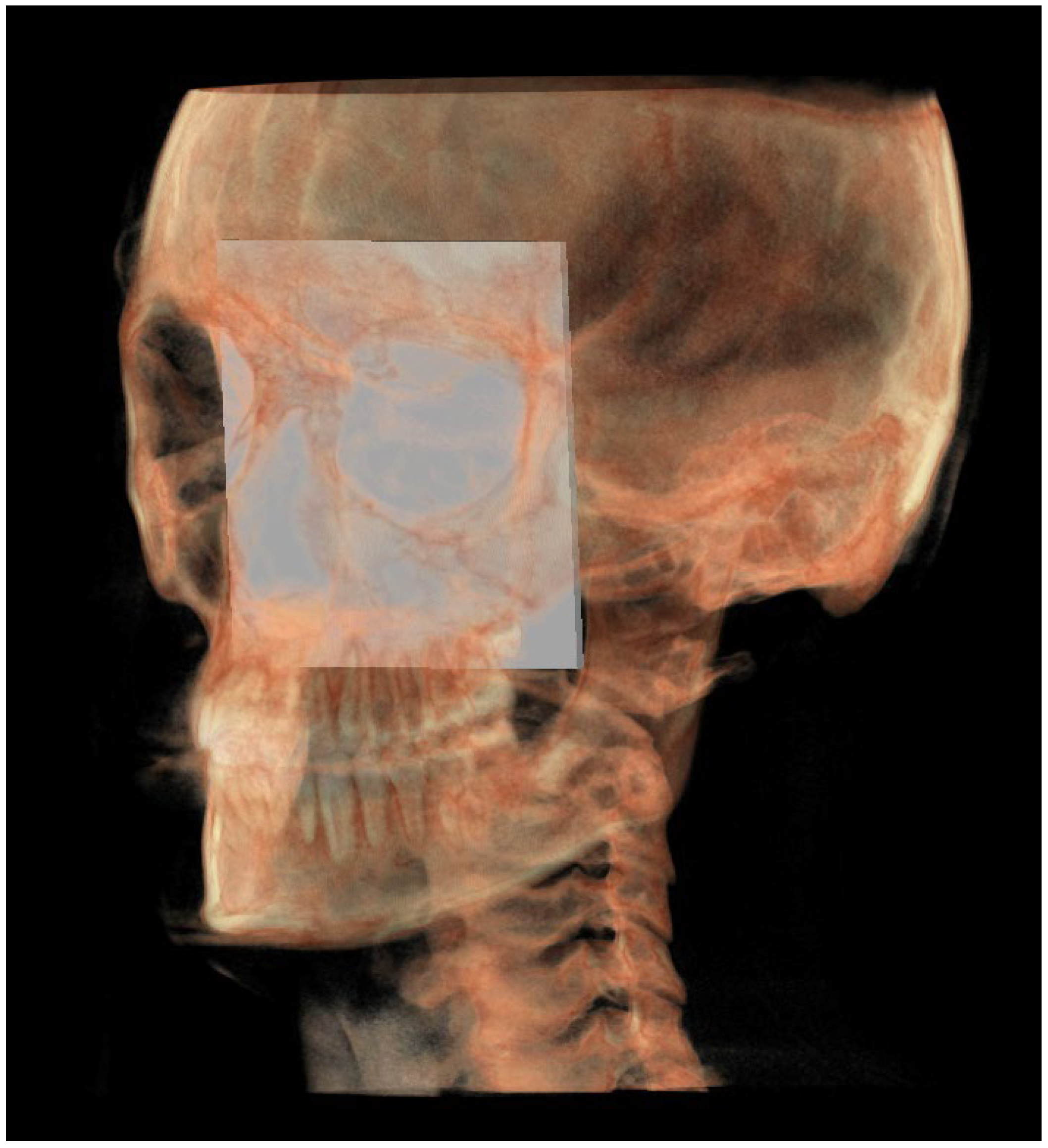 Diagnostics 13 02337 g004 Diagnostics 13 02337 g004