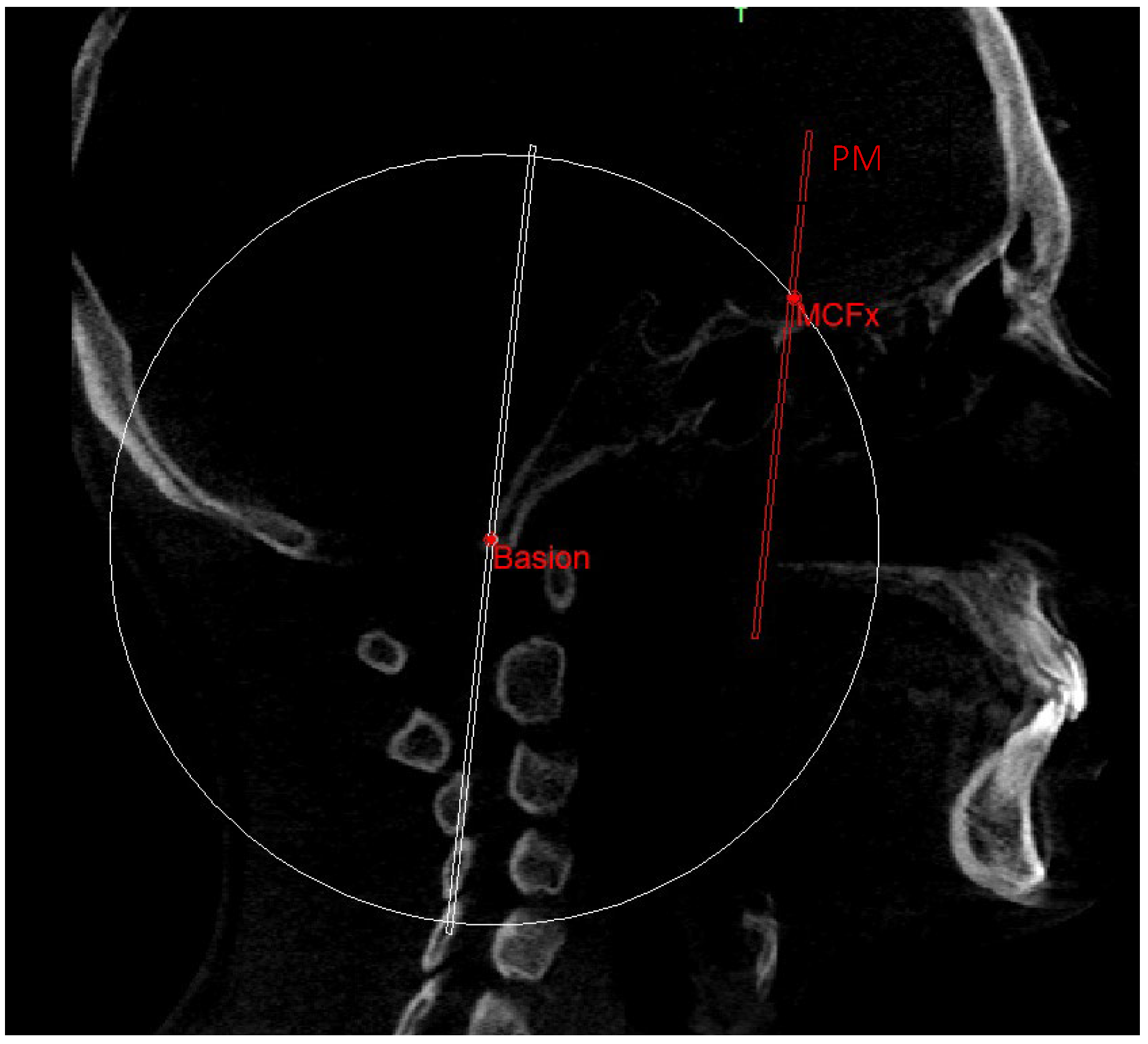 Diagnostics 13 02337 g009 Diagnostics 13 02337 g009