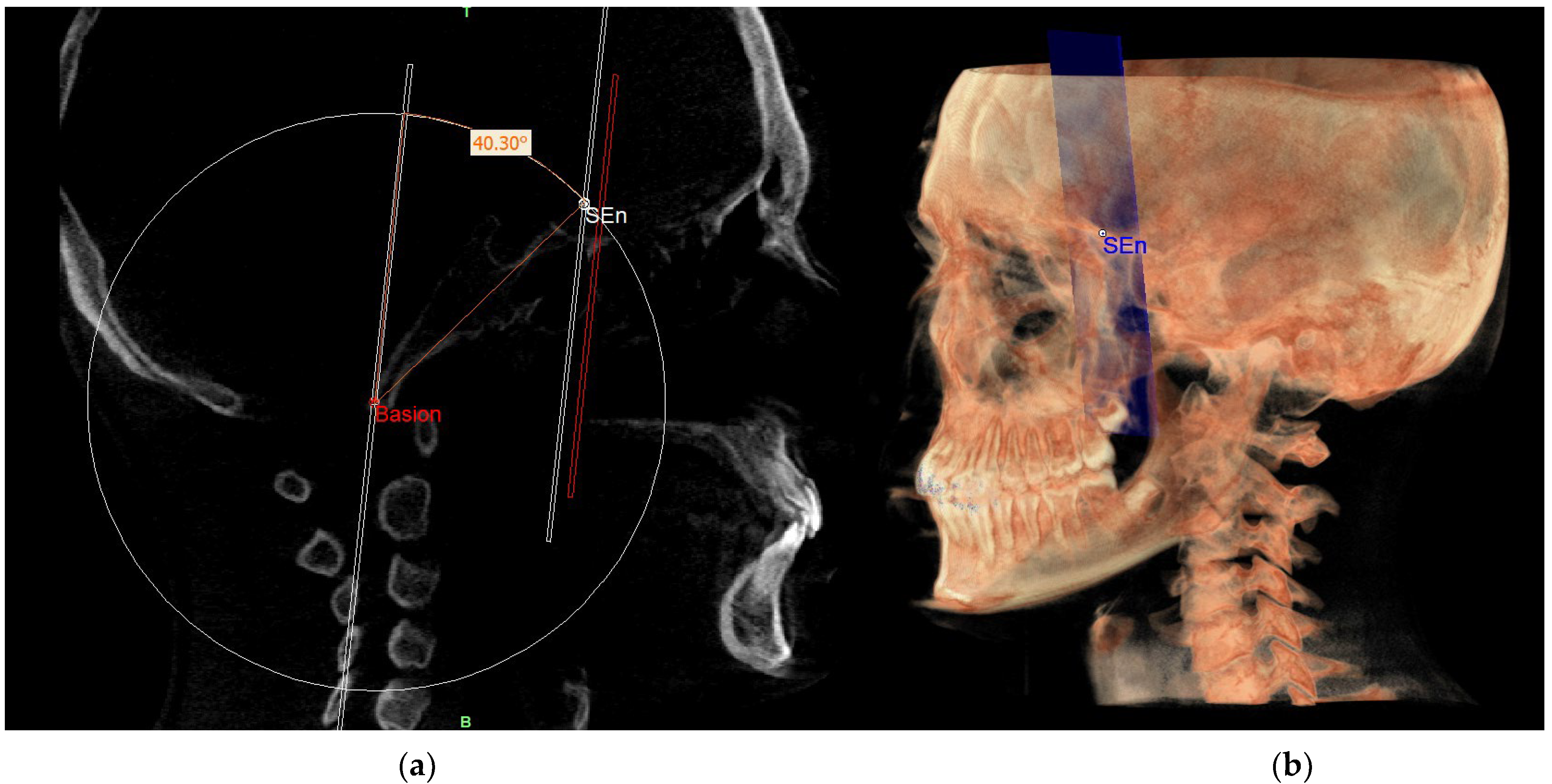Diagnostics 13 02337 g011 Diagnostics 13 02337 g011