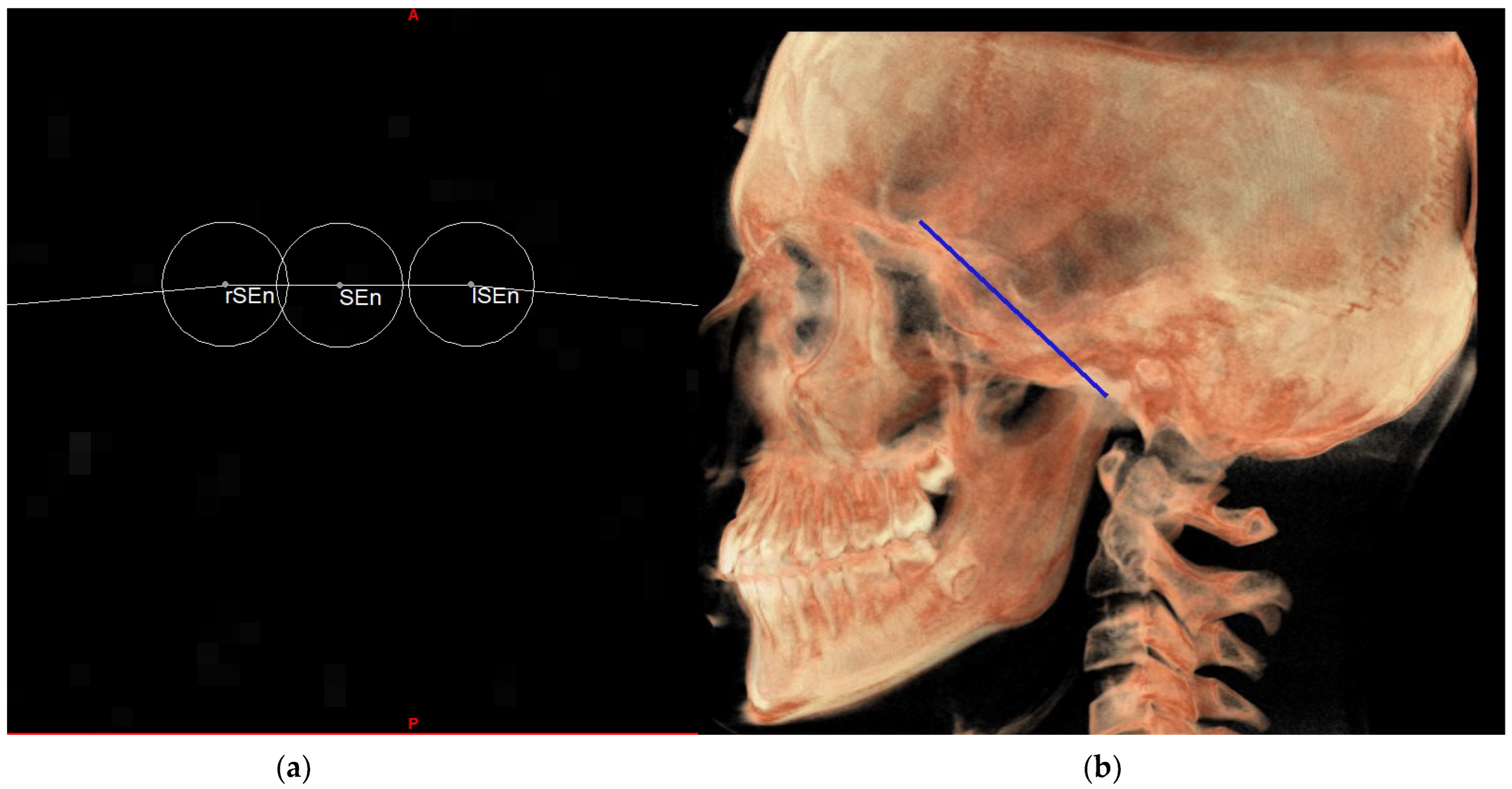 Diagnostics 13 02337 g012 Diagnostics 13 02337 g012