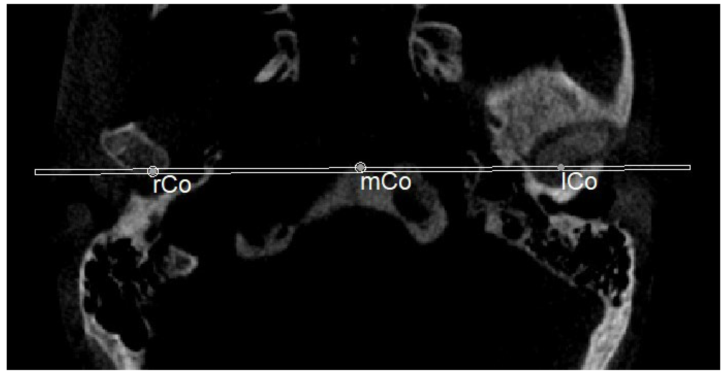 Diagnostics 13 02337 g013 Diagnostics 13 02337 g013