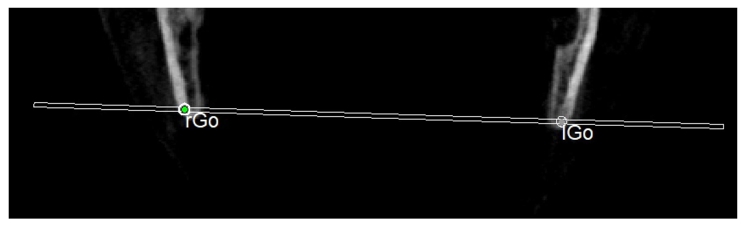 Diagnostics 13 02337 g014 Diagnostics 13 02337 g014