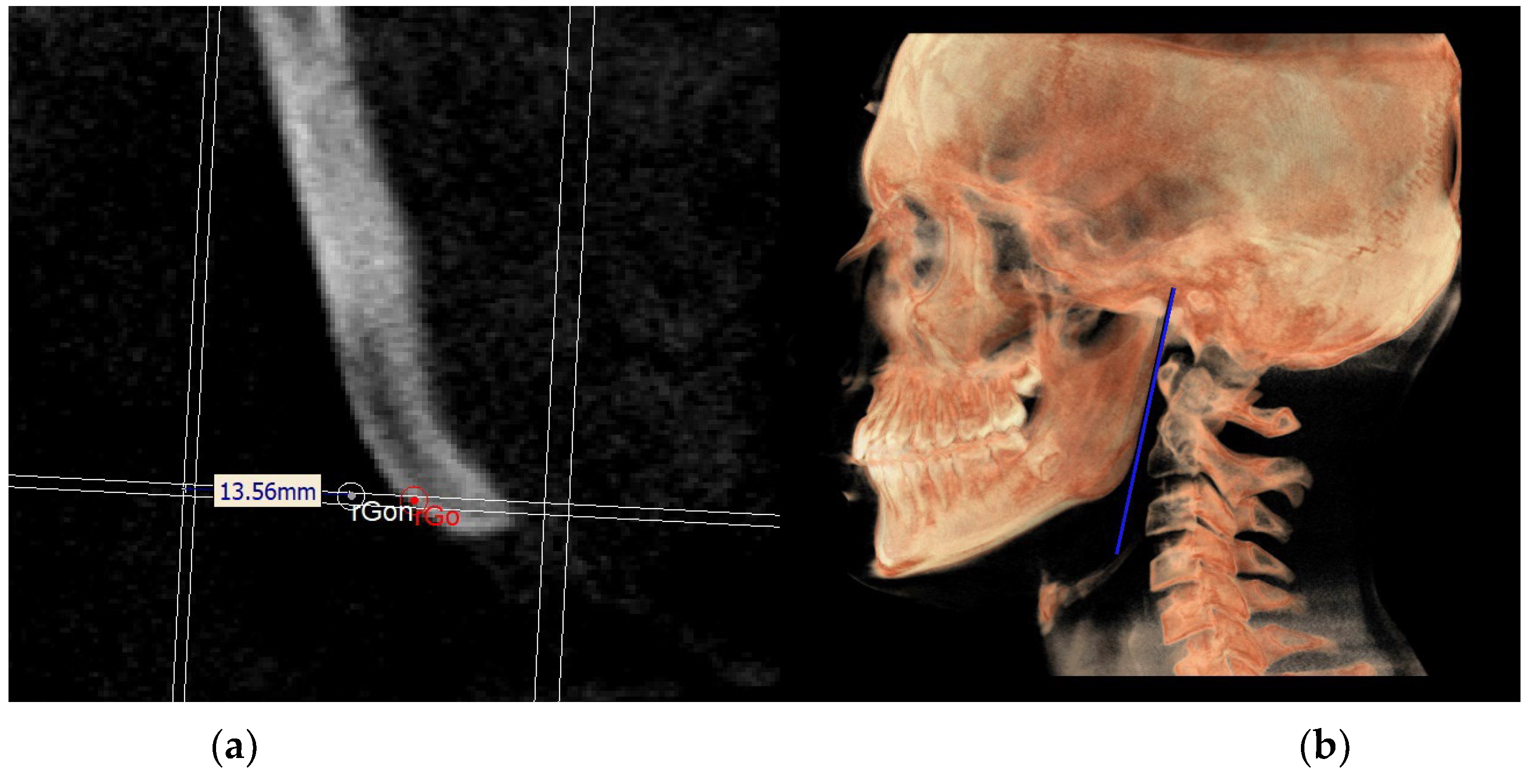 Diagnostics 13 02337 g015 Diagnostics 13 02337 g015