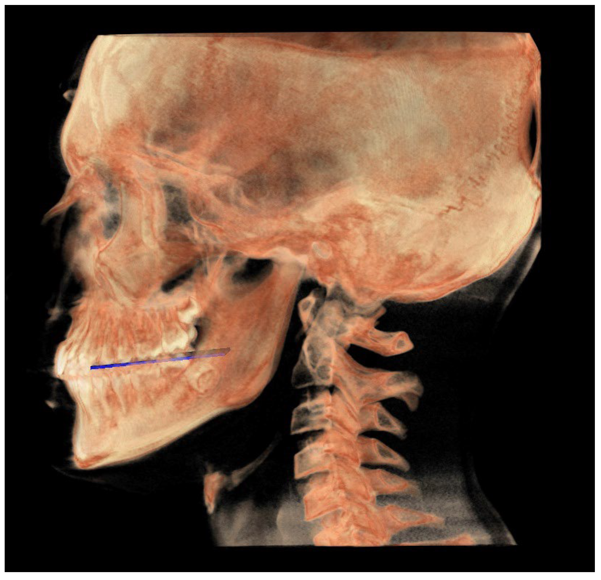 Diagnostics 13 02337 g016 Diagnostics 13 02337 g016