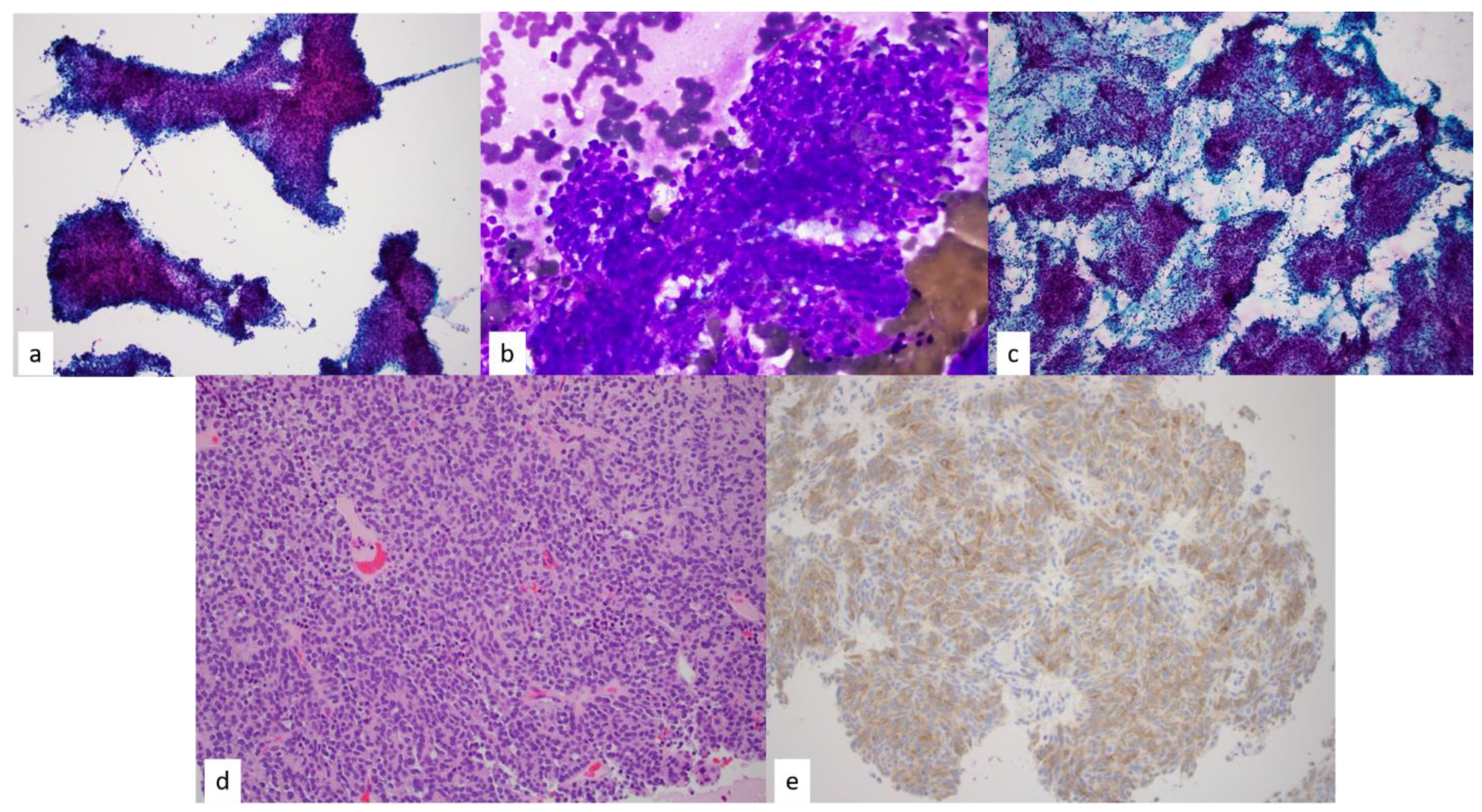 Diagnostics 13 02400 g008 Diagnostics 13 02400 g008