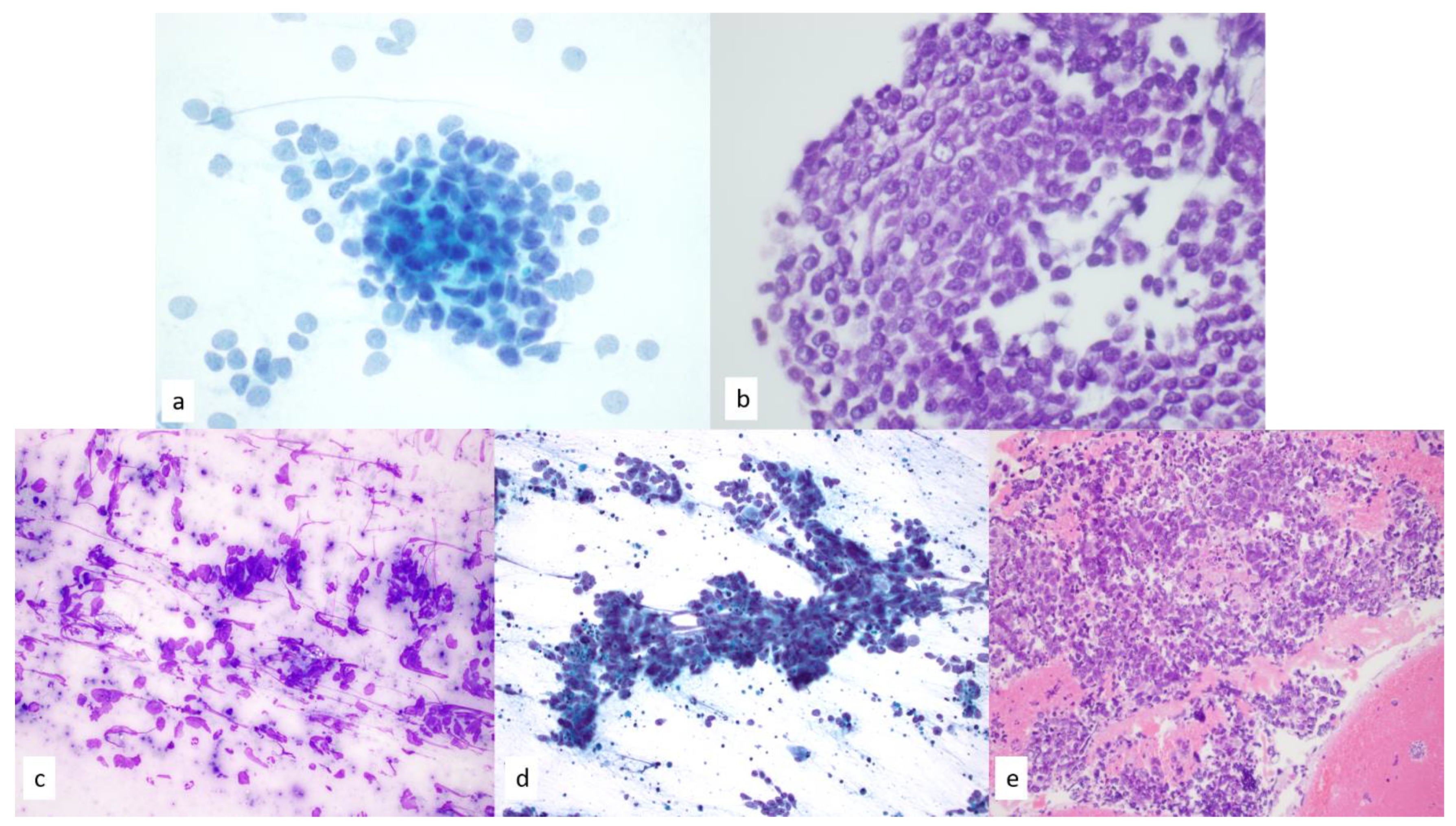 Diagnostics 13 02400 g011 Diagnostics 13 02400 g011