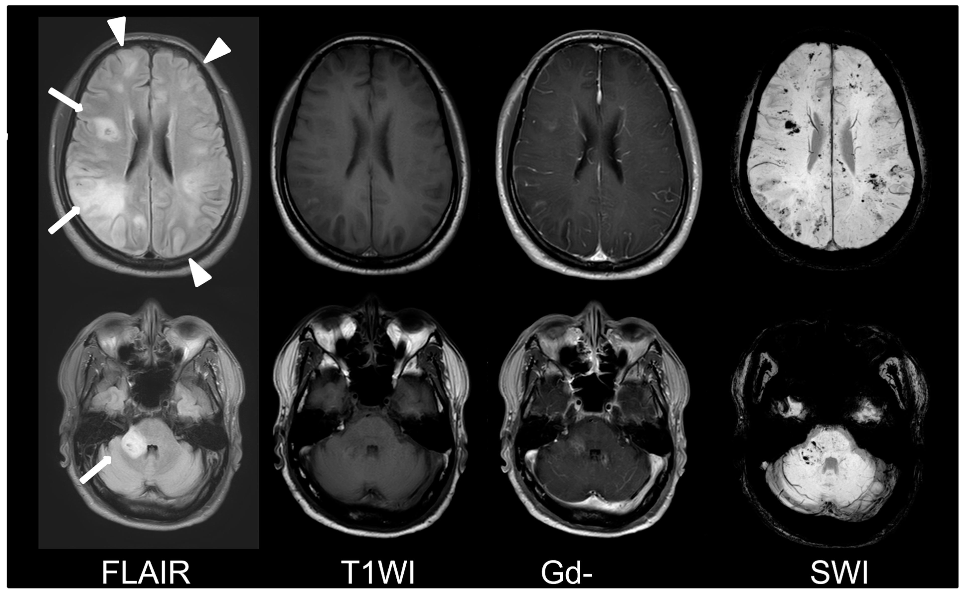 Diagnostics | Free Full-Text | Rapid Progressive Fatal Acute ...