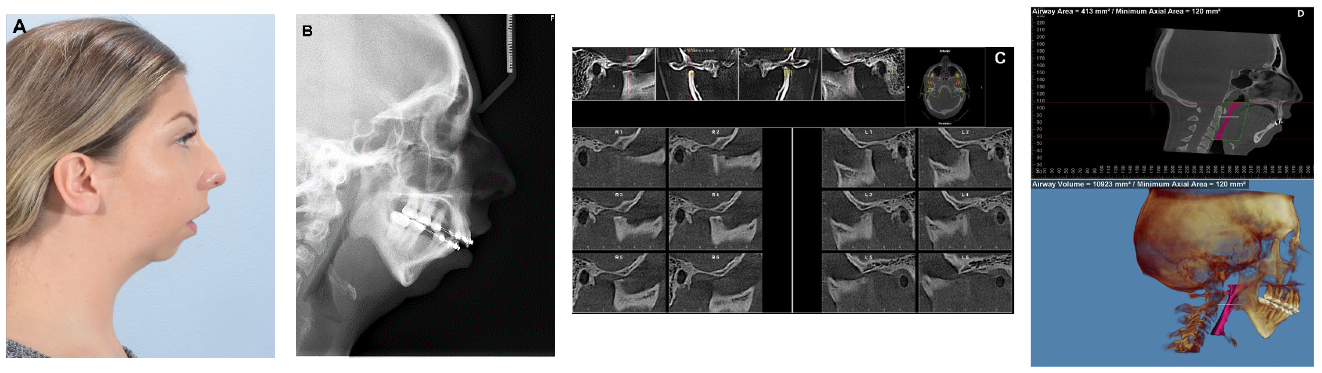 Diagnostics Free Full Text Concomitant Temporomandibular Joint