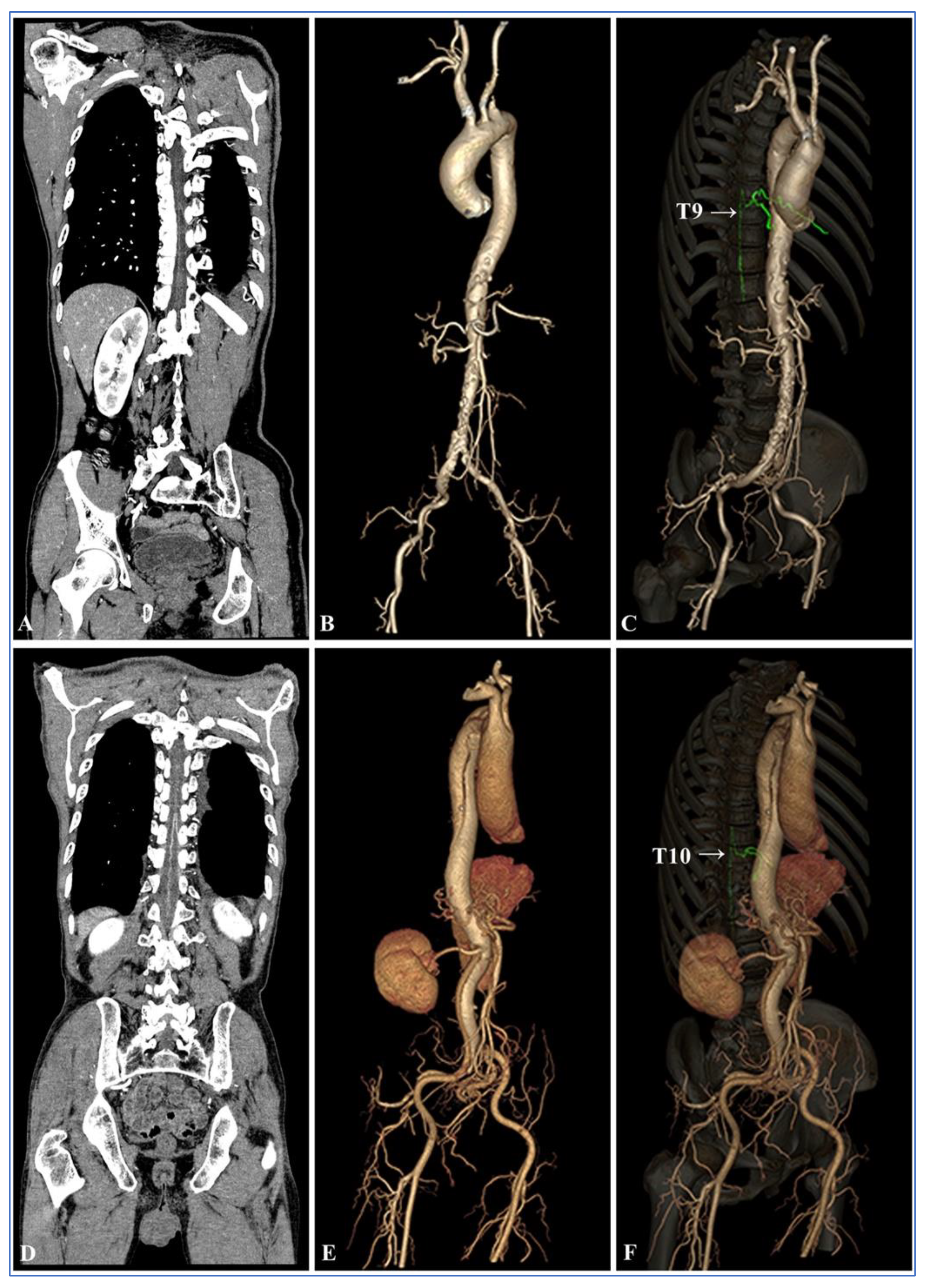 Diagnostics 13 02495 g006