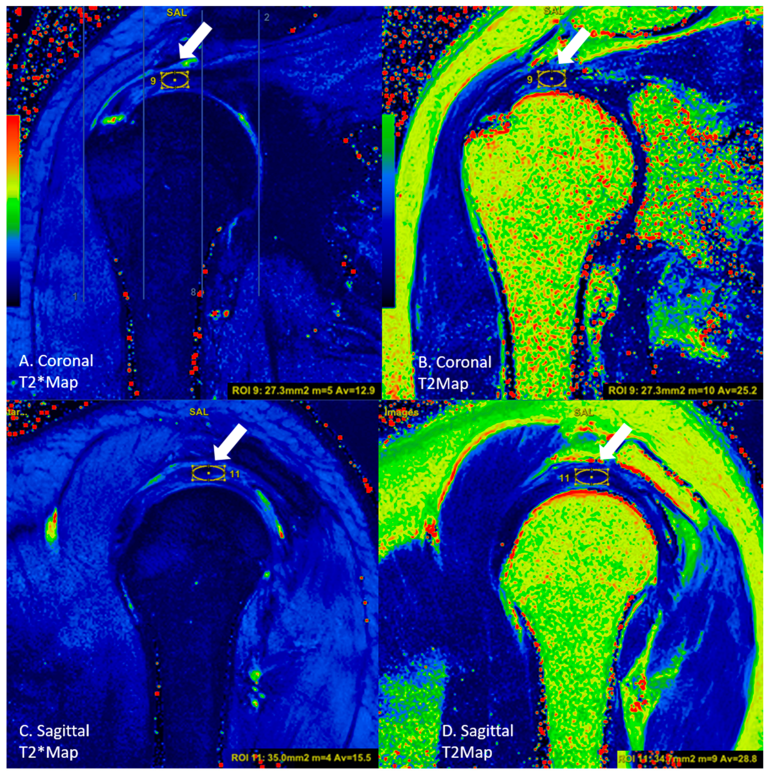 Diagnostics 13 02534 g004 Diagnostics 13 02534 g004