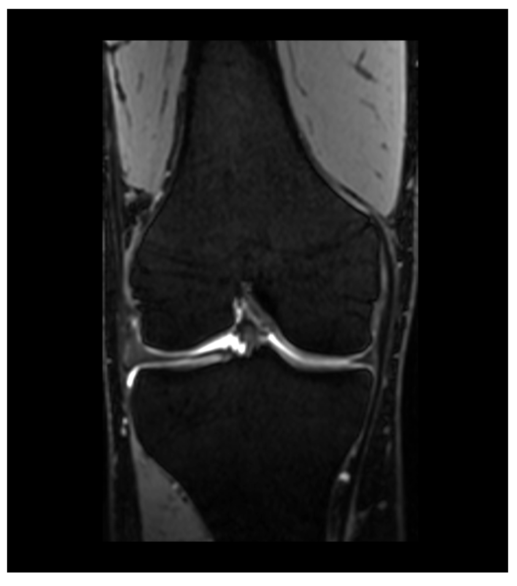 Diagnostics 13 02586 g004 Diagnostics 13 02586 g004