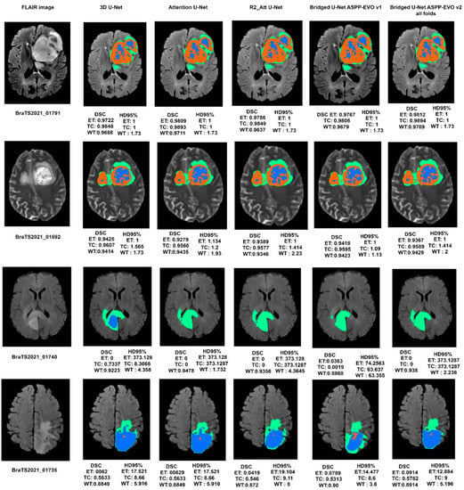 Diagnostics | Free Full-Text | Bridged-U-Net-ASPP-EVO and Deep Learning ...