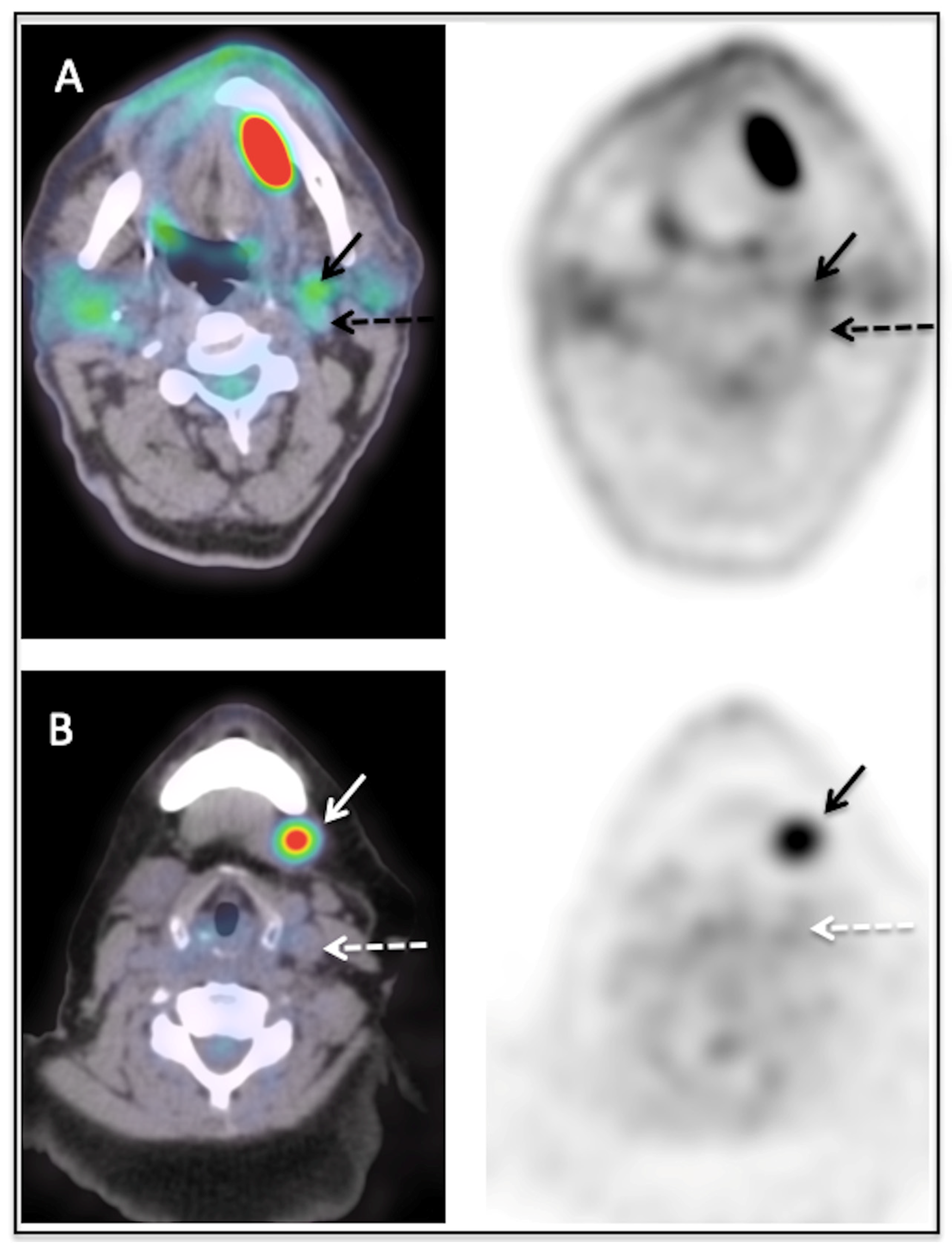 The diagnostic accuracy and clinical impact of FDG-PET/CT follow