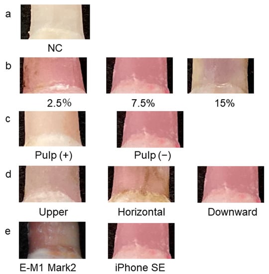 https://www.mdpi.com/diagnostics/diagnostics-13-02699/article_deploy/html/images/diagnostics-13-02699-g001-550.jpg