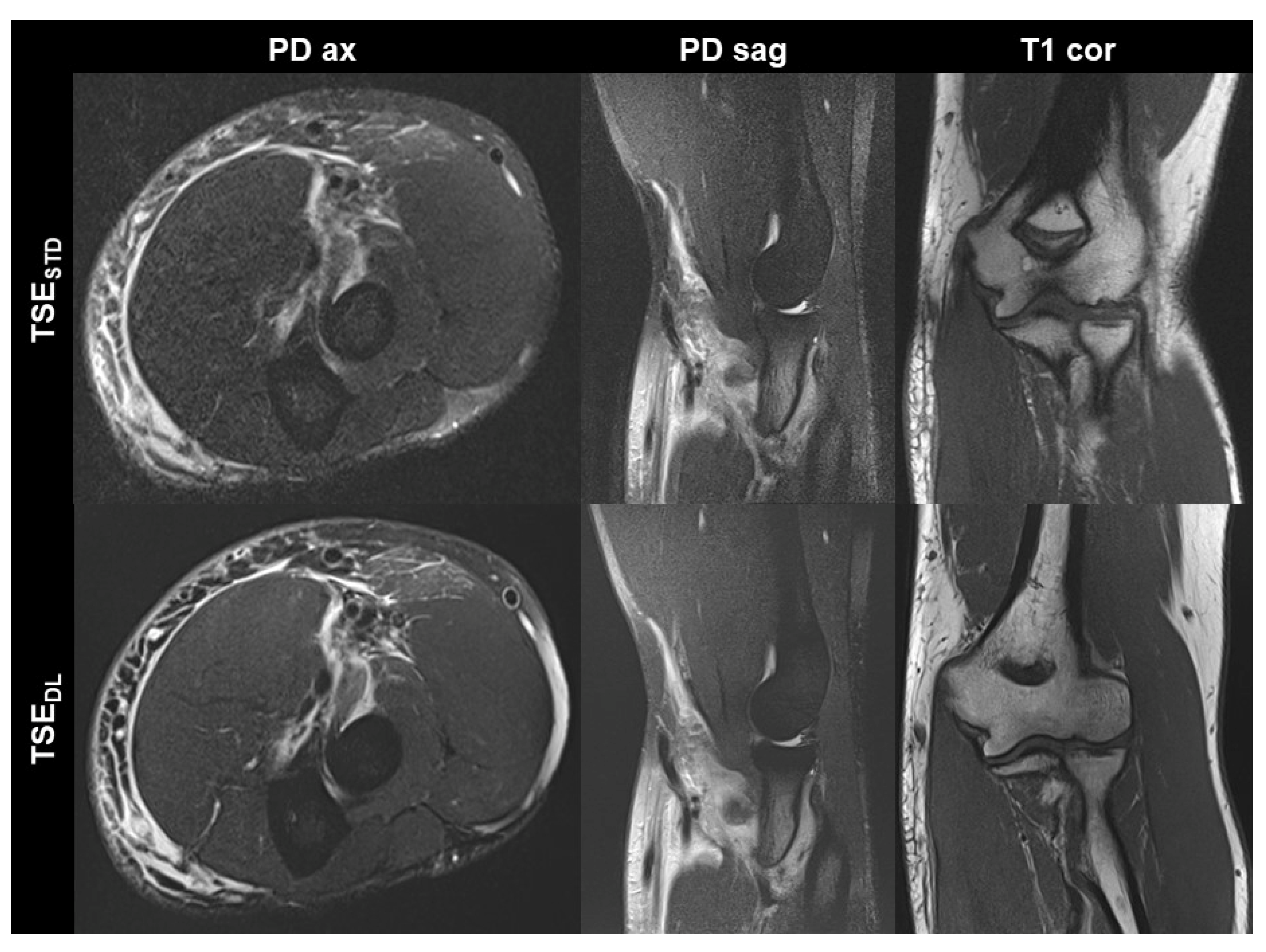 Diagnostics Free Full Text Faster Elbow MRI With Deep Learning   Diagnostics 13 02747 G003 